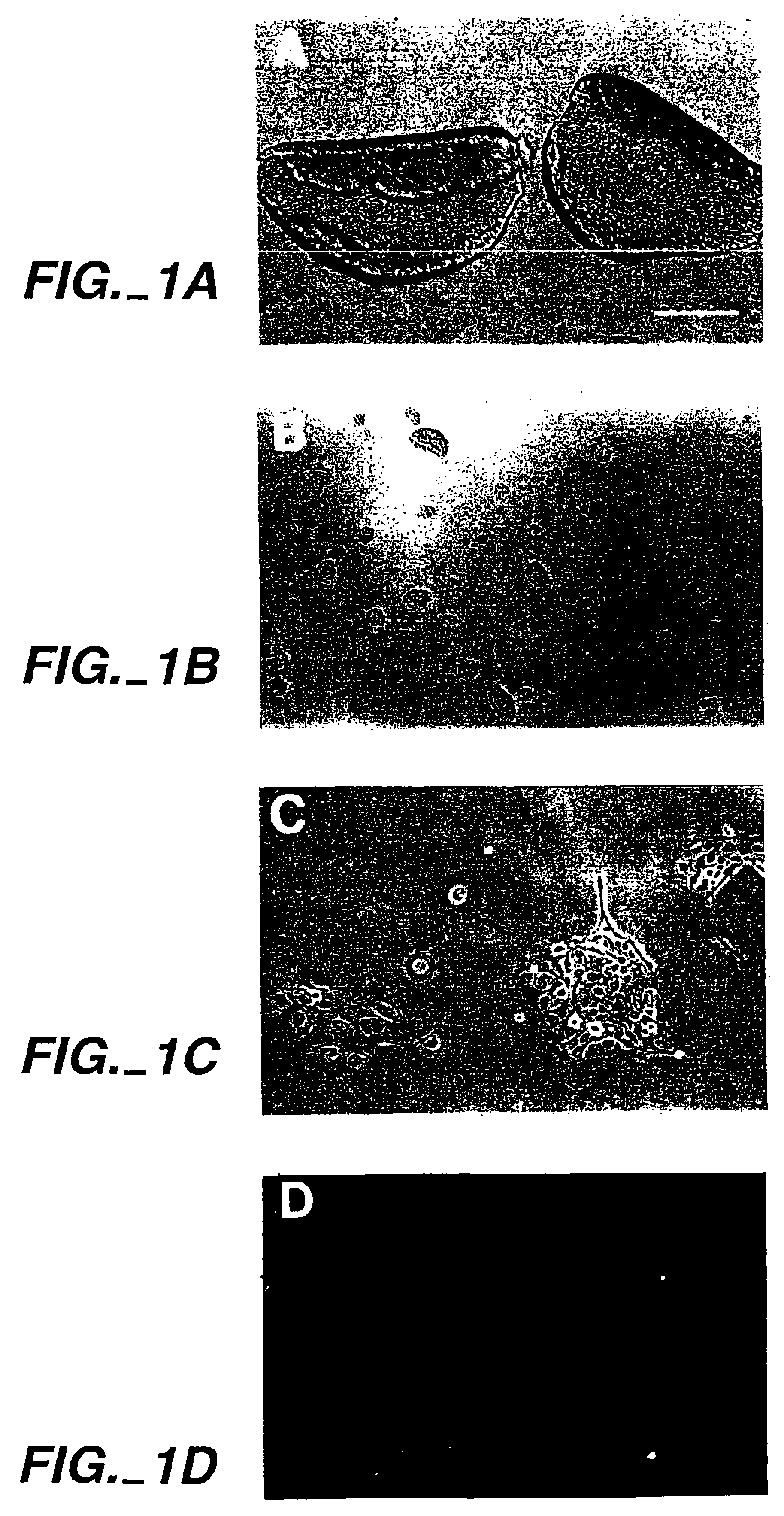 Treatment of inner ear hair cells