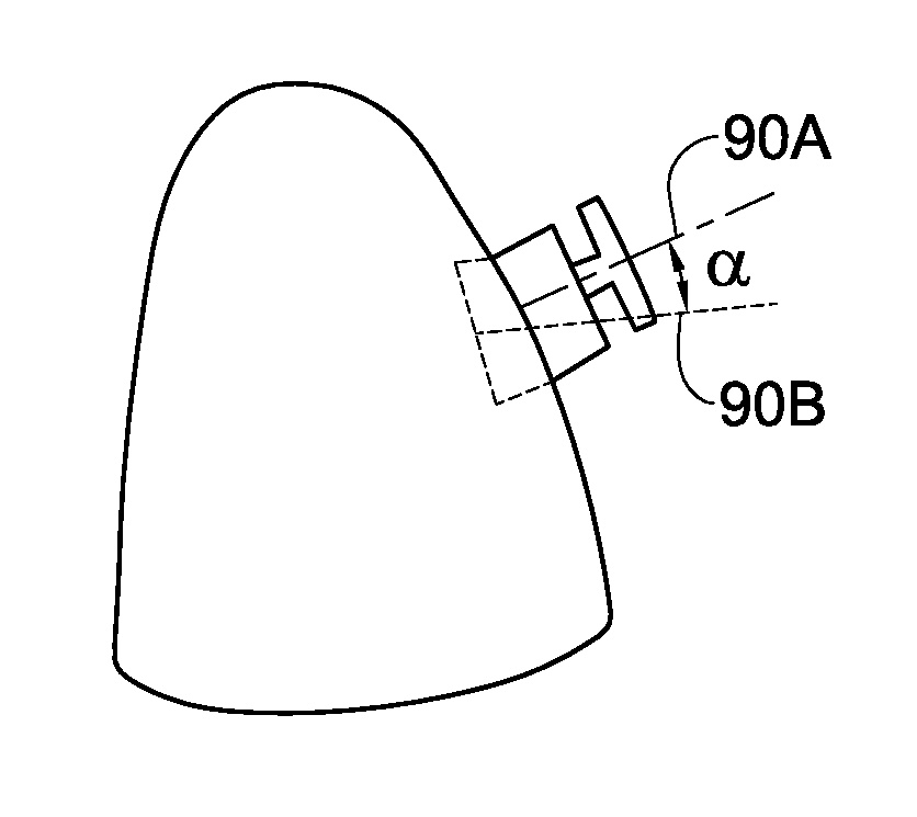 Method, system and model for indirect bonding