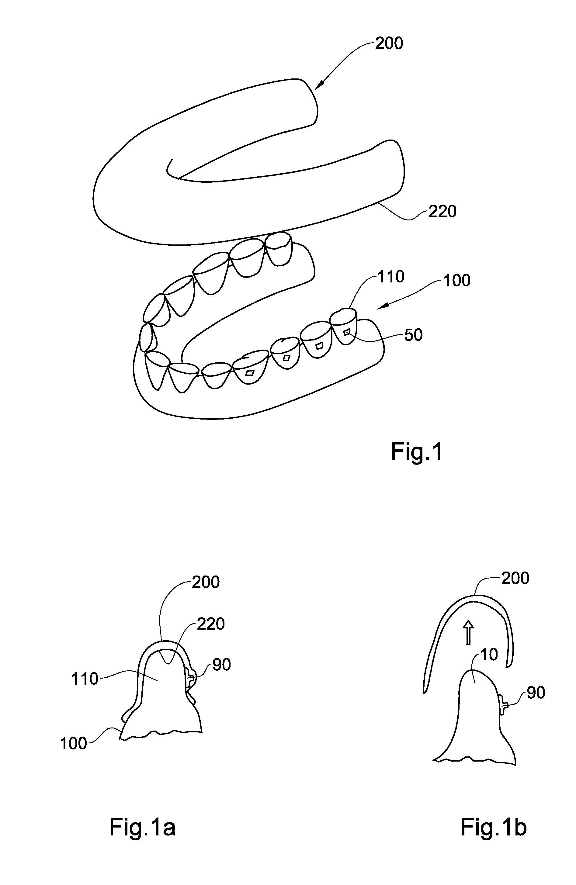 Method, system and model for indirect bonding