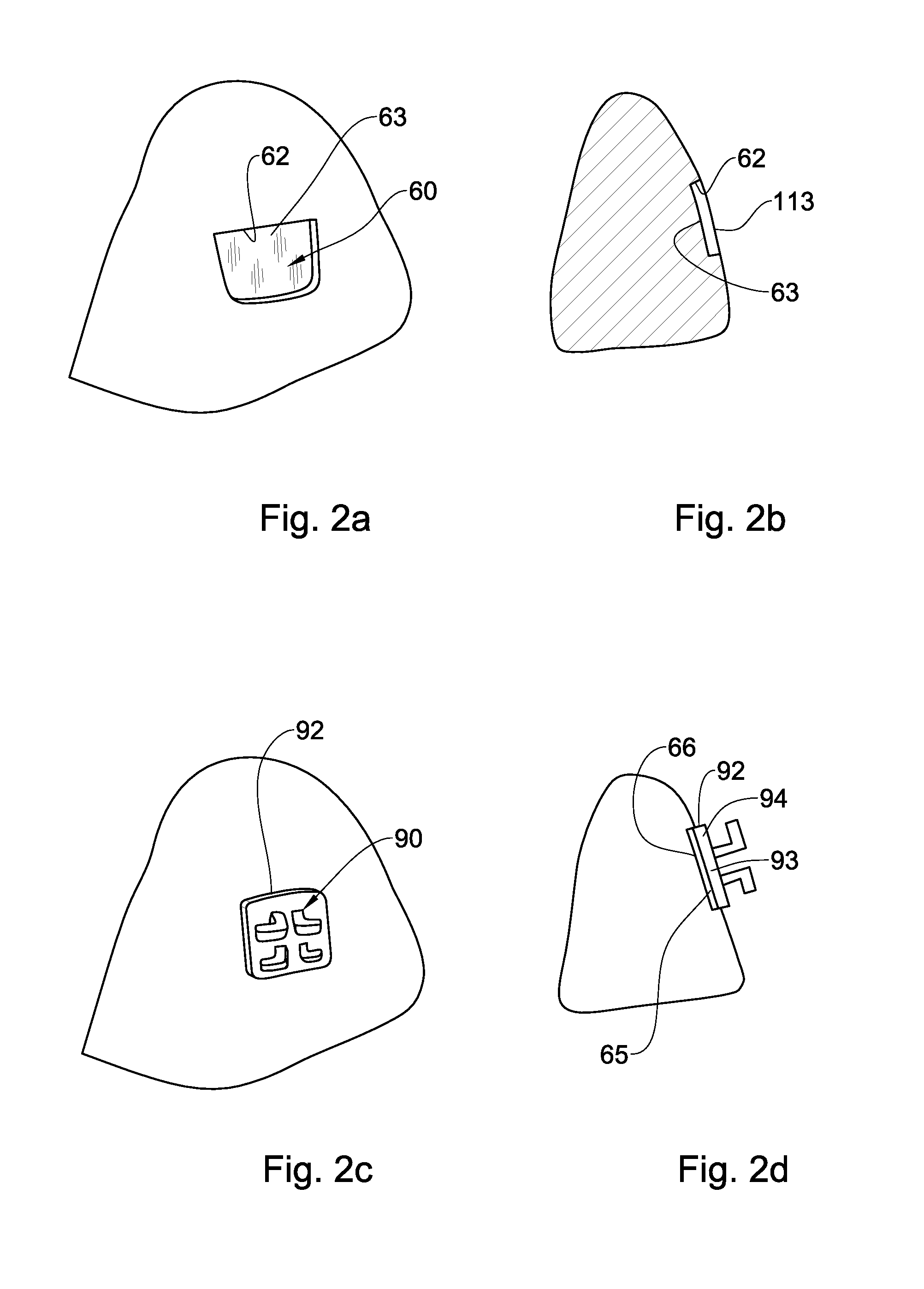 Method, system and model for indirect bonding