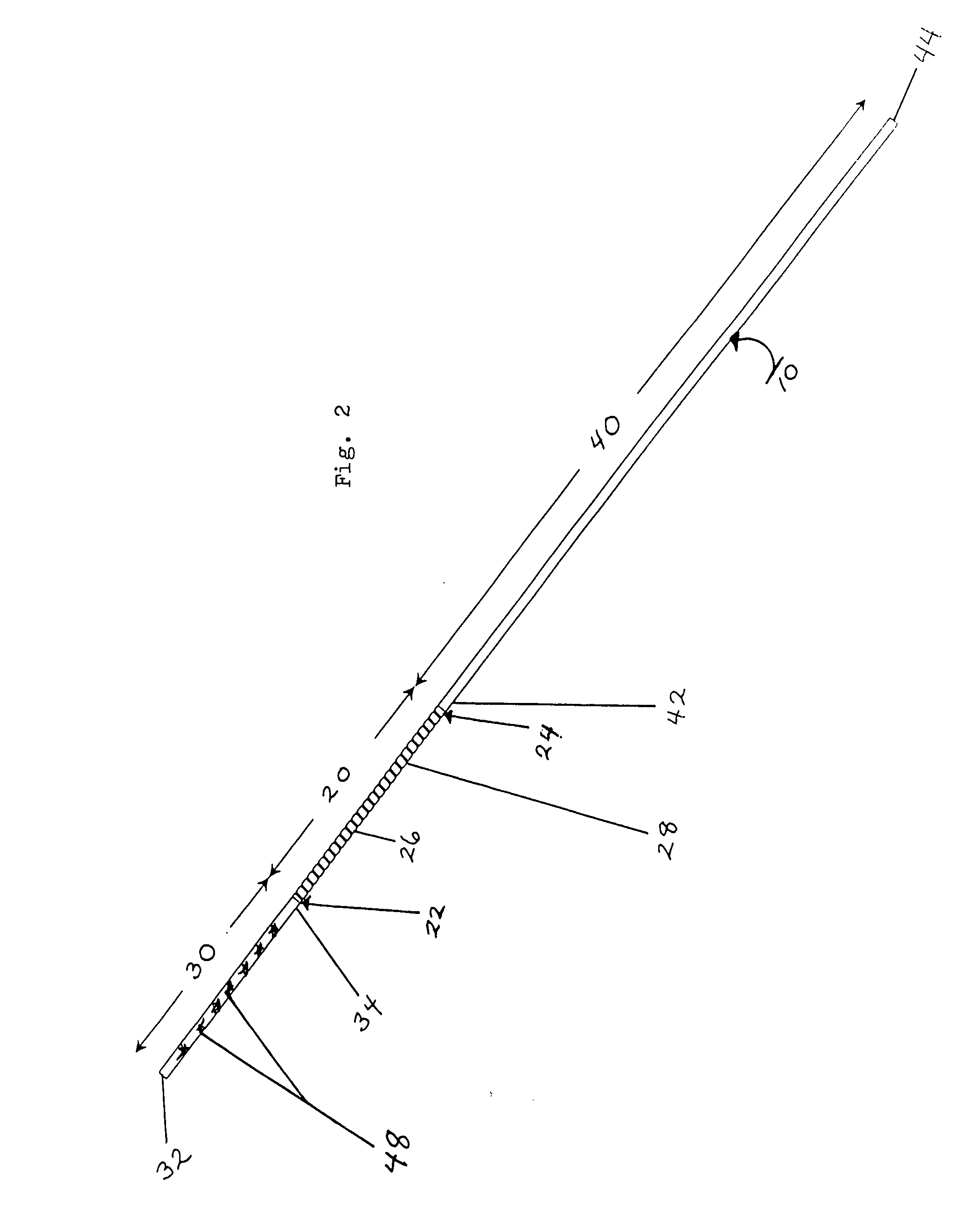 Arteriovenous access for hemodialysis employing a vascular balloon catheter and an improved hybrid endovascular technique