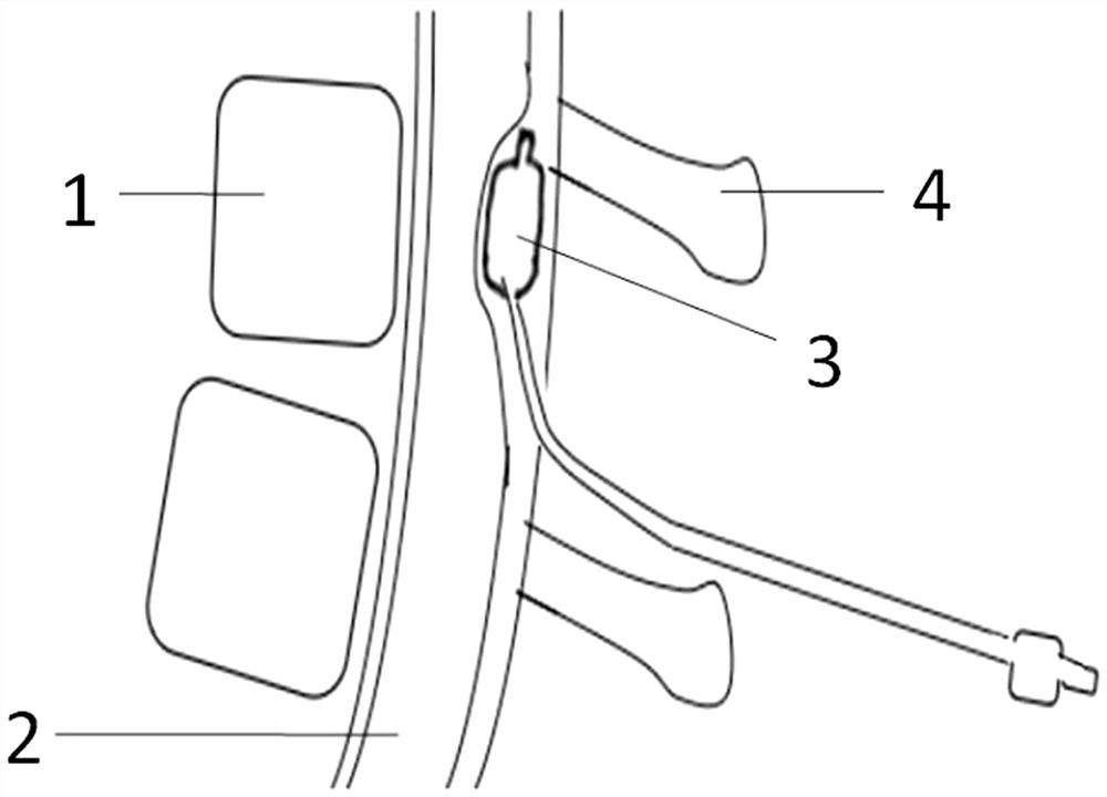 Adjustable macaque spinal cord injury method