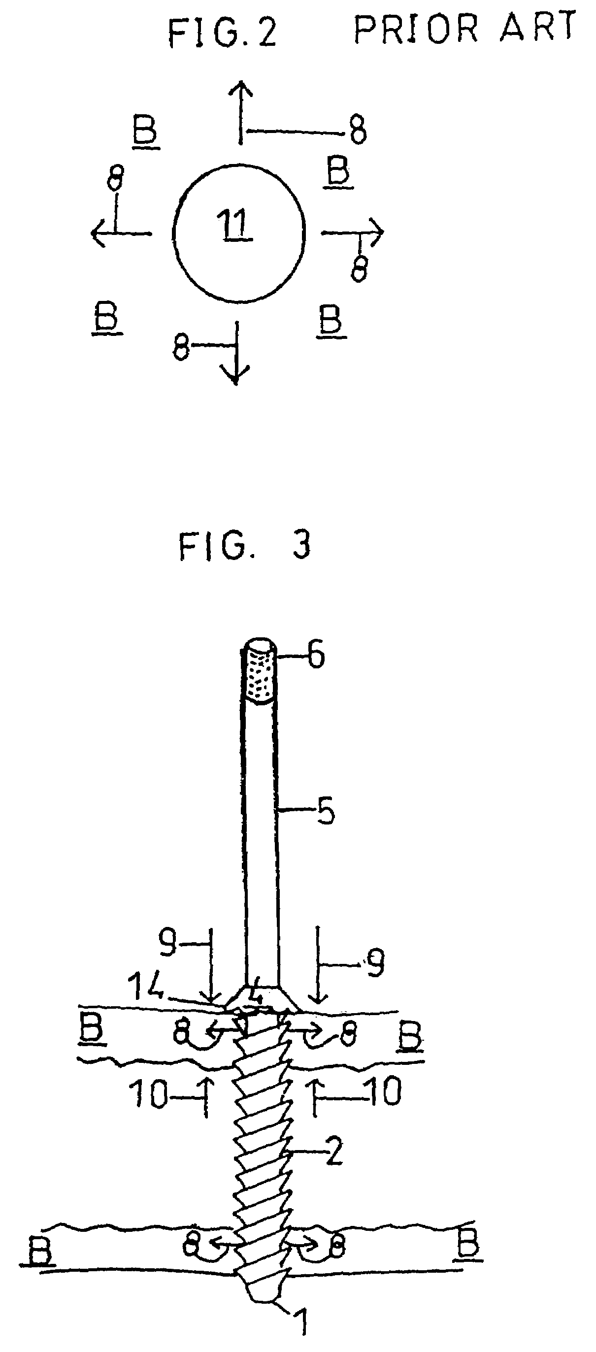 Renew compression screw