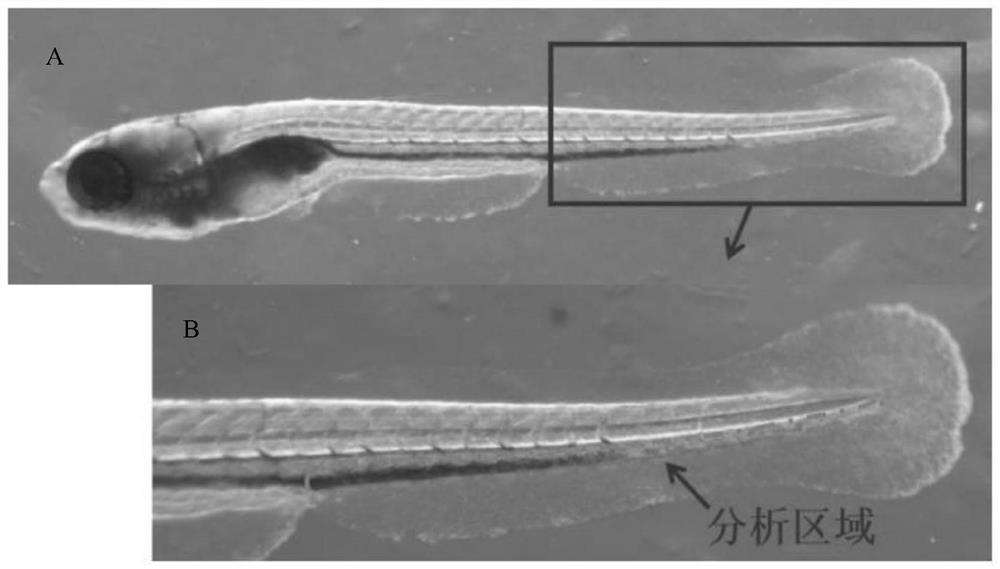 Anti-inflammatory and blood fat-reducing composition, product and preparation method and application of anti-inflammatory and blood fat-reducing composition