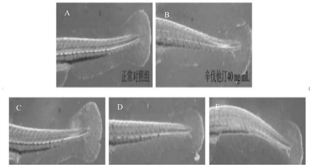 Anti-inflammatory and blood fat-reducing composition, product and preparation method and application of anti-inflammatory and blood fat-reducing composition