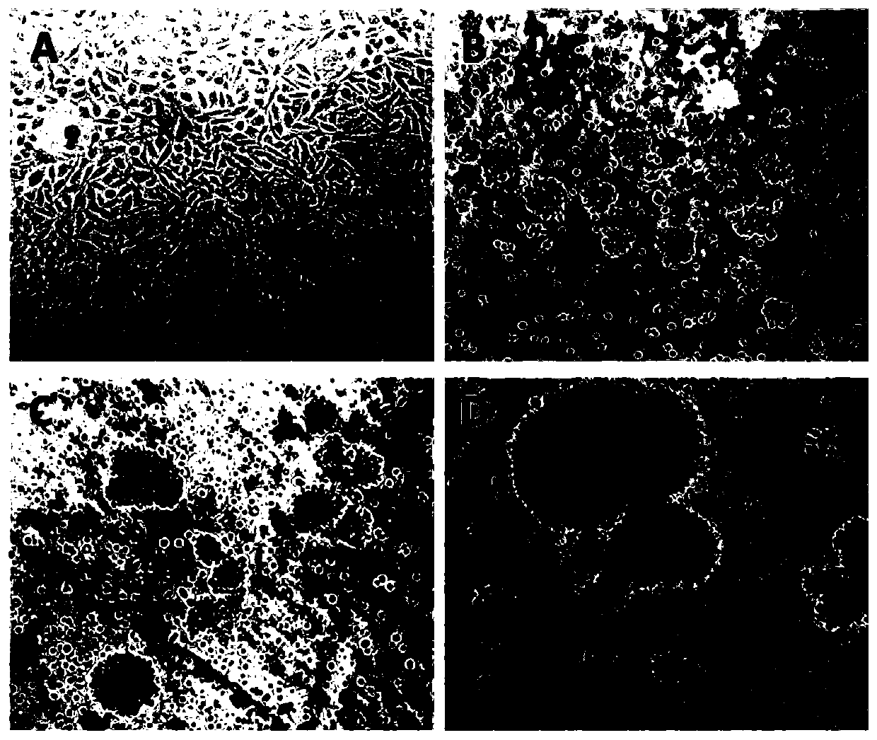 Application of artemisinin in drugs to kill breast carcinoma stem cells