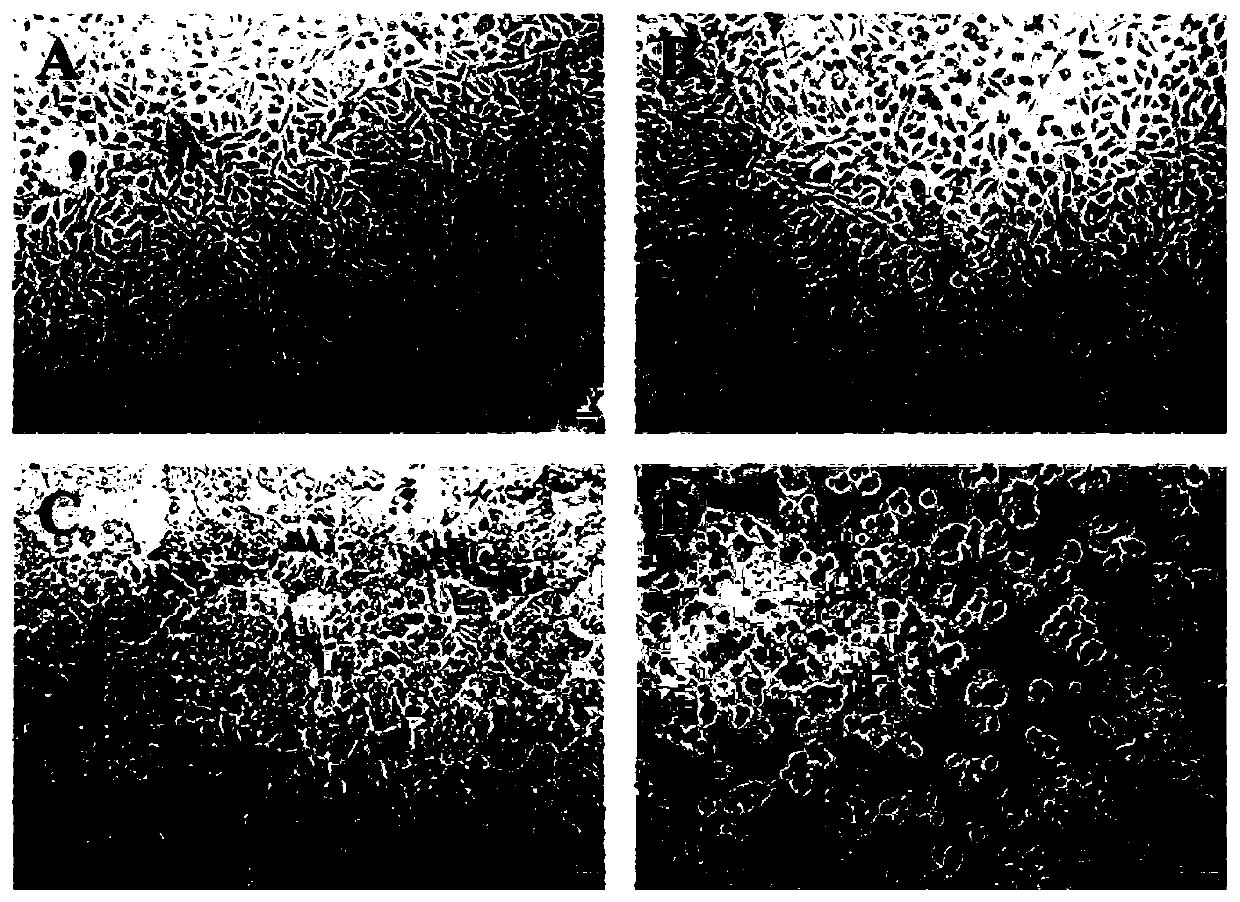 Application of artemisinin in drugs to kill breast carcinoma stem cells