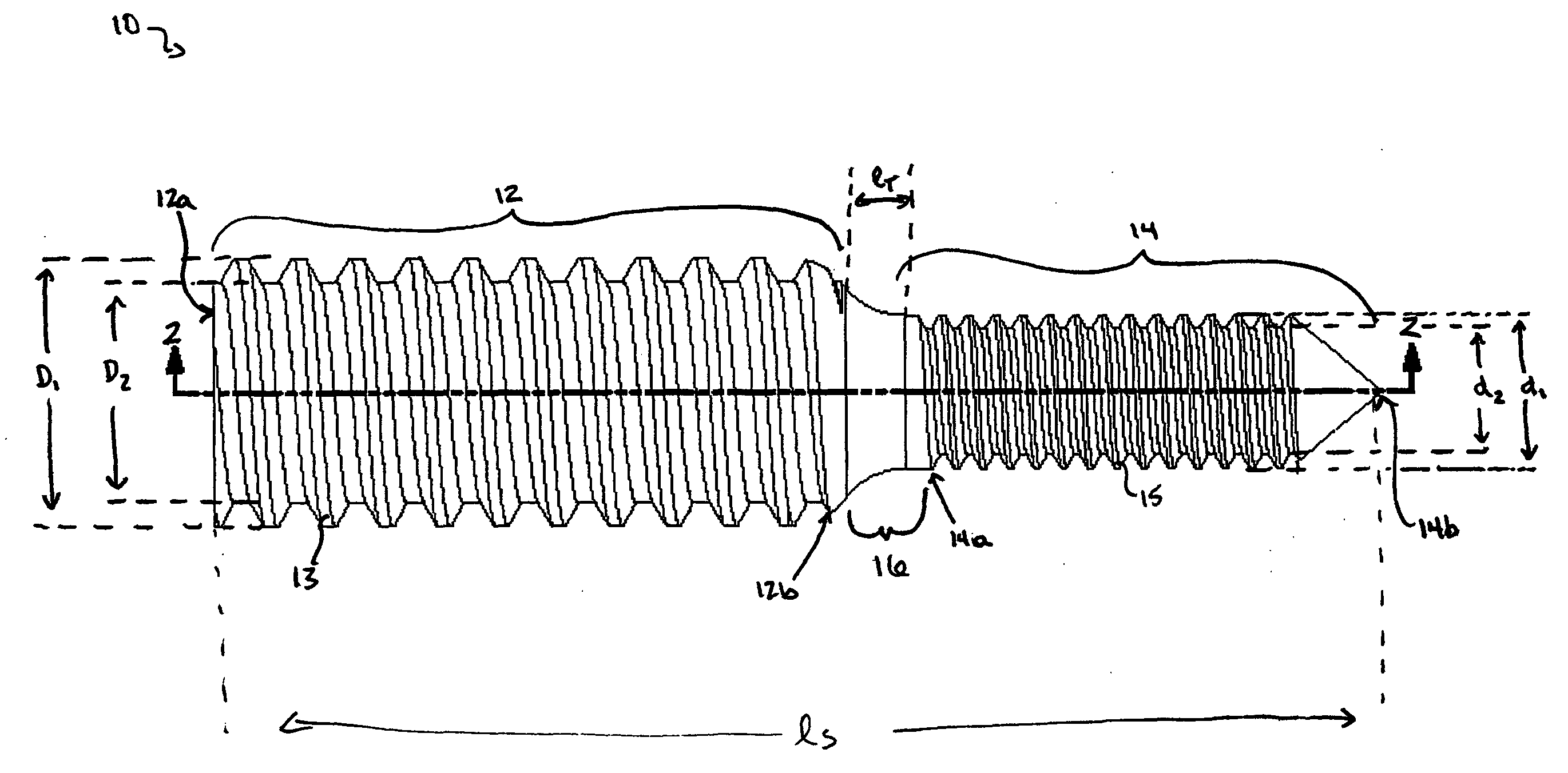 Distraction screw