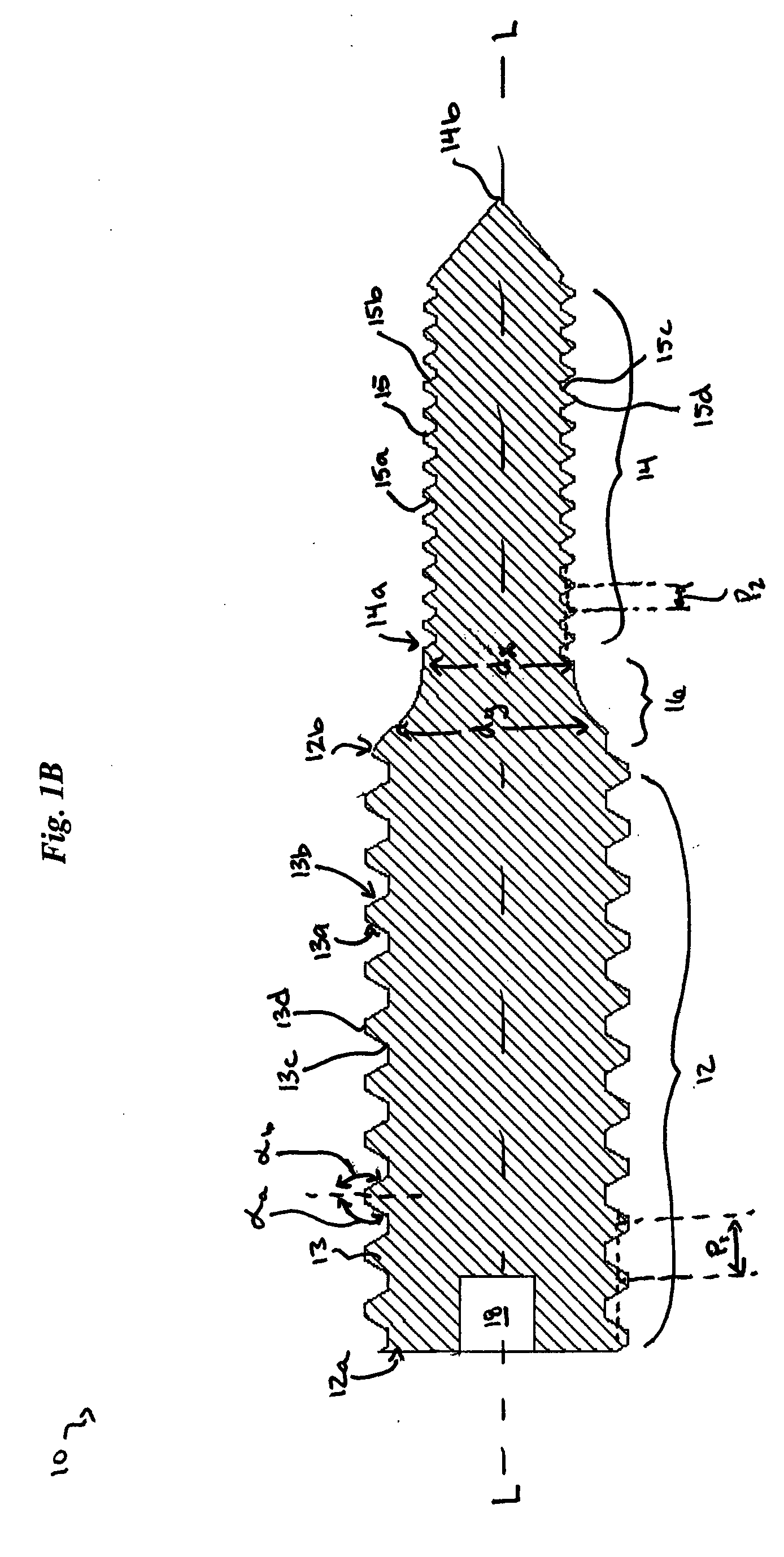 Distraction screw