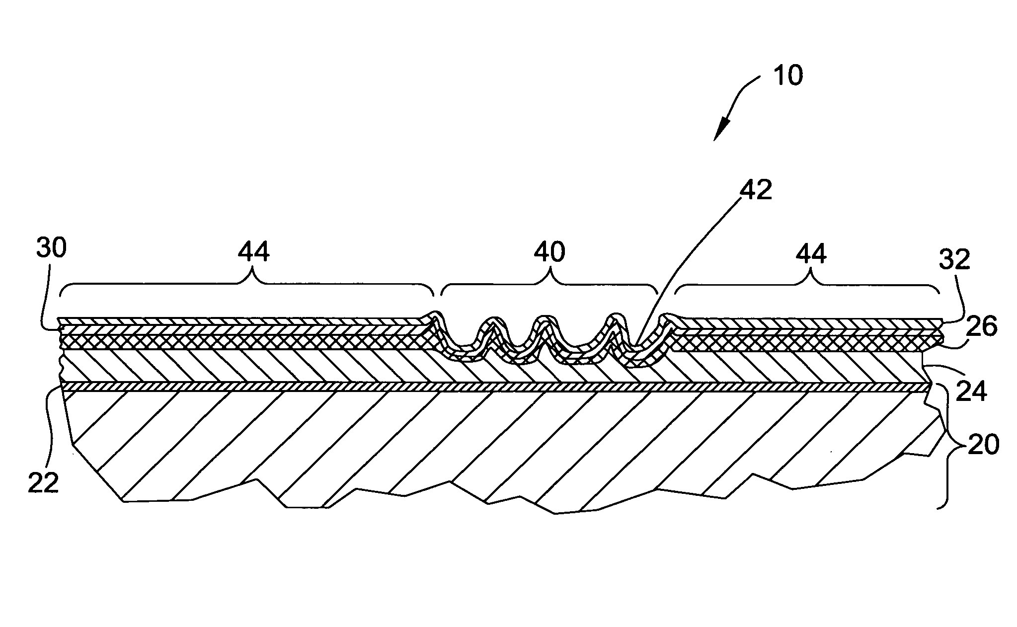 Chrome plated articles of variable surface appearance