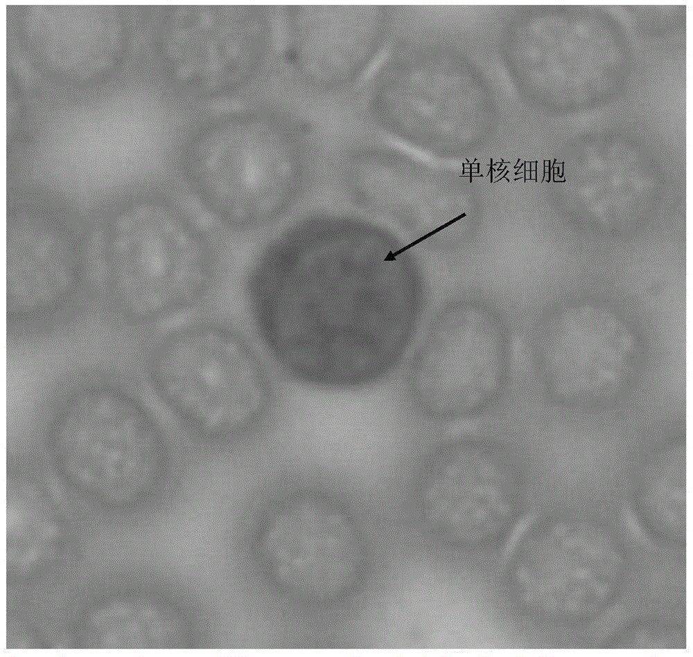 Alpha-naphthol acetate esterase staining kit