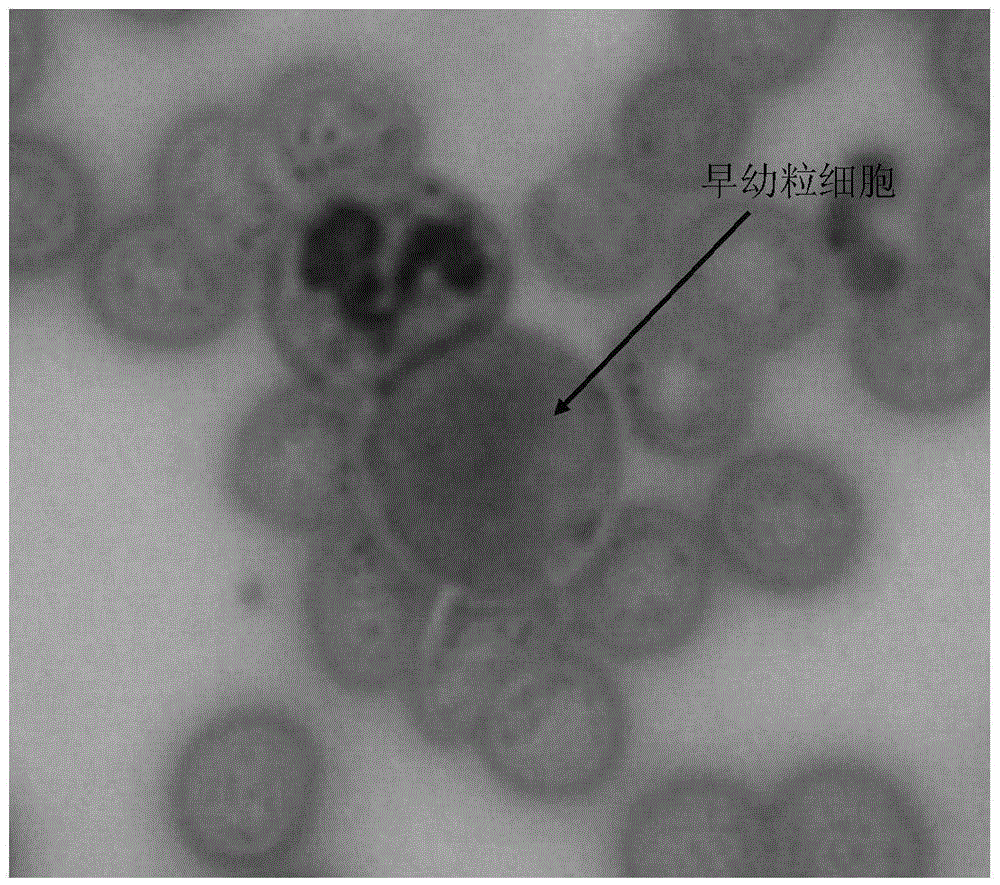 Alpha-naphthol acetate esterase staining kit