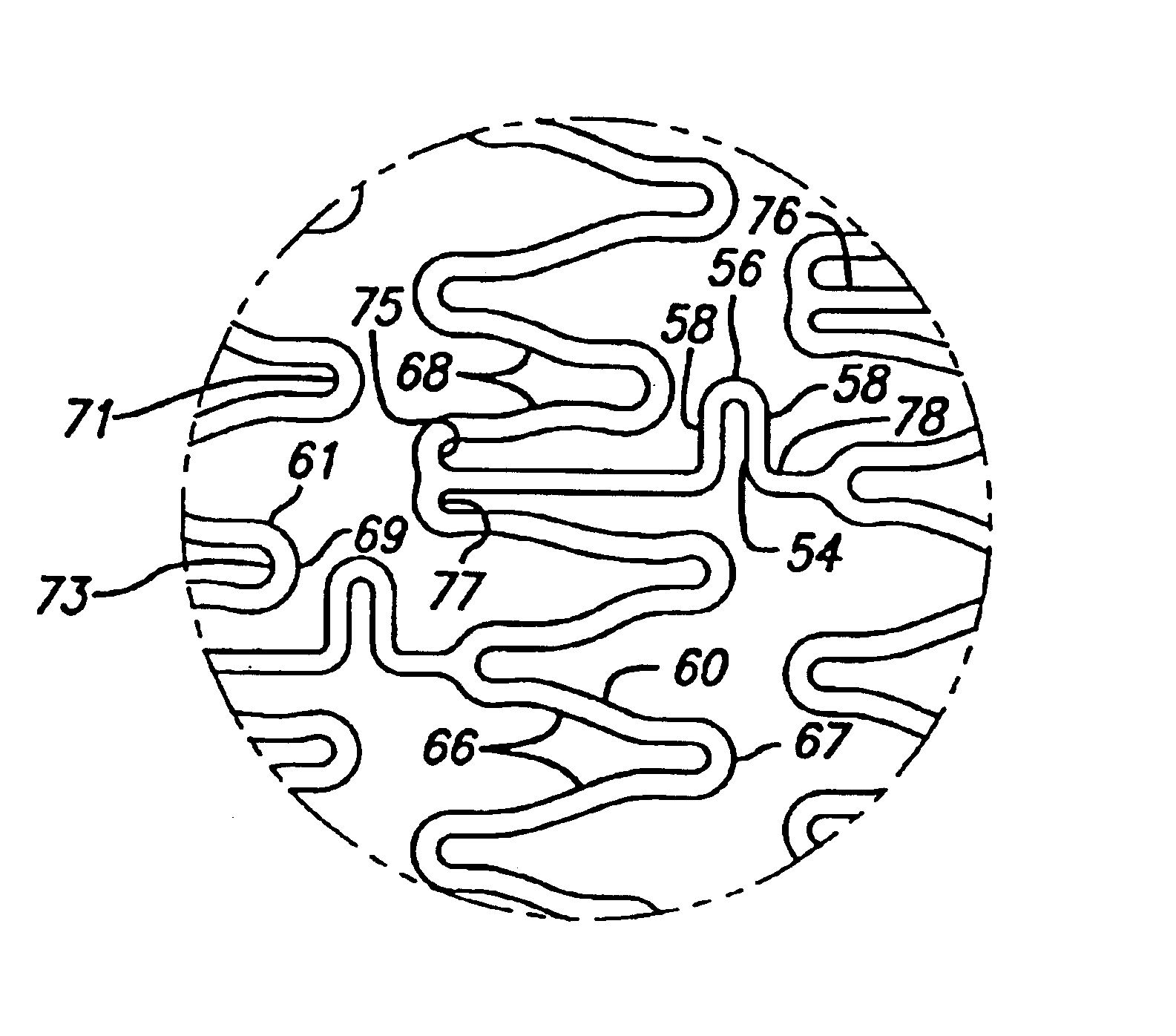 Intravascular stent