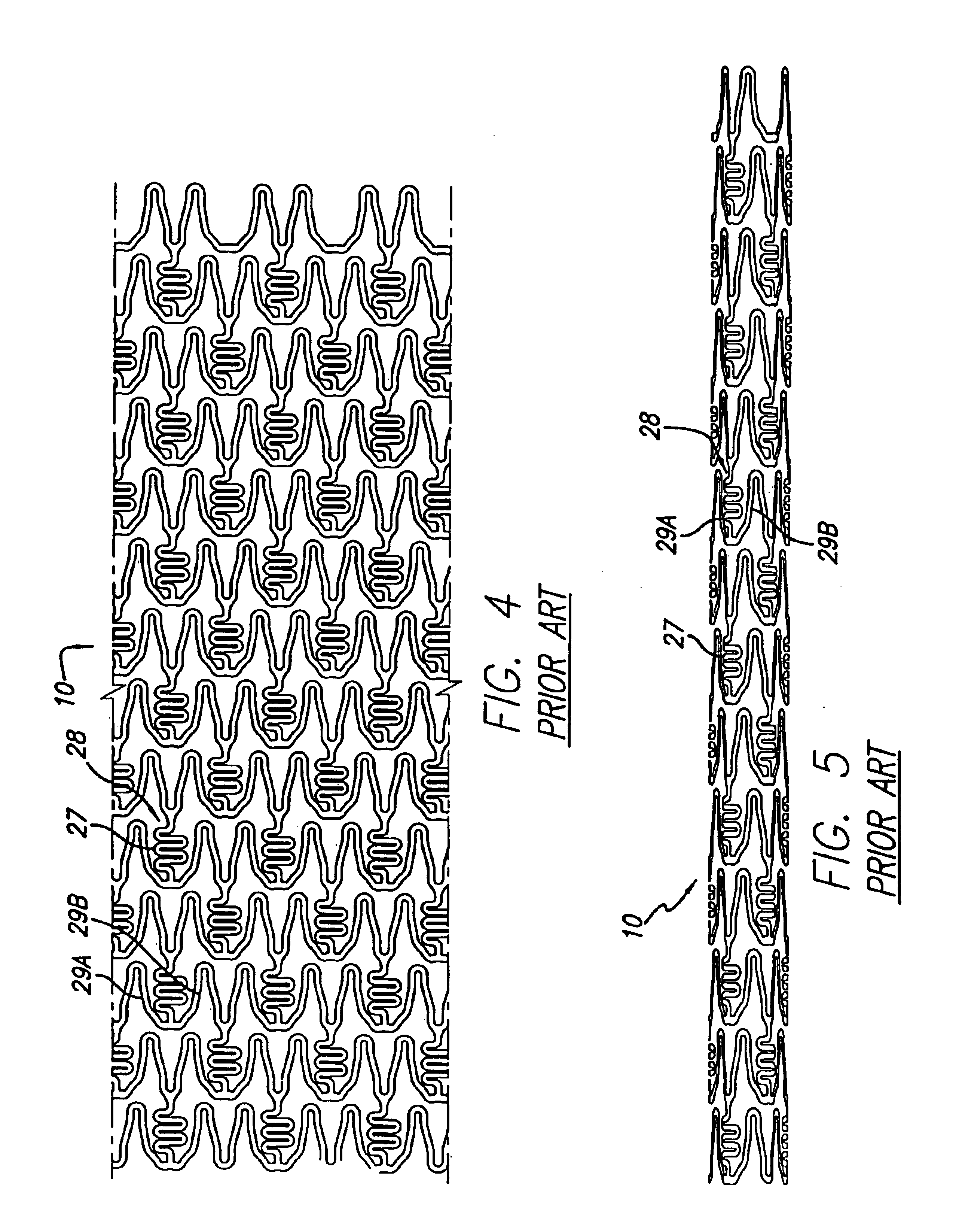 Intravascular stent