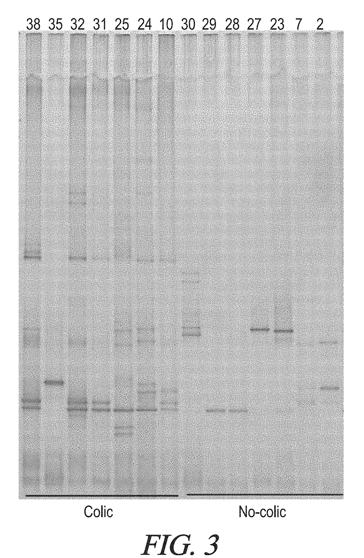 Nutritional compositions providing dietary management of colic