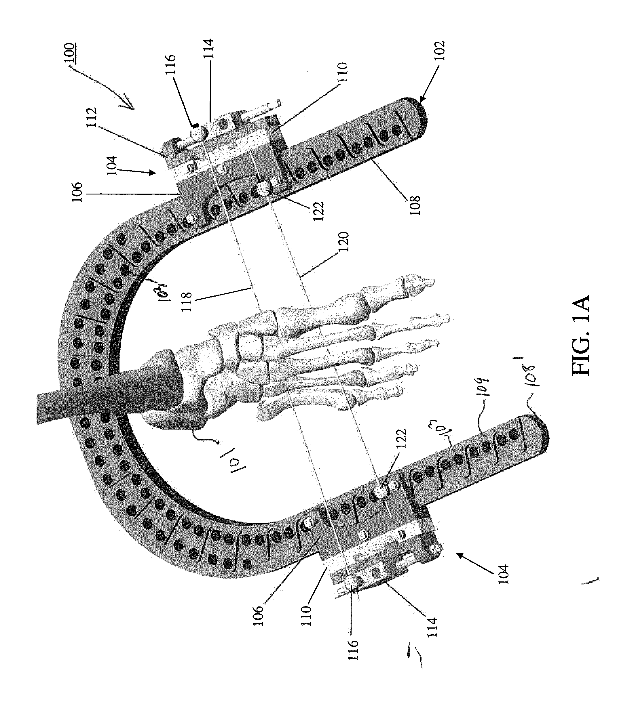 Dynamic External Fixator And Methods For Use