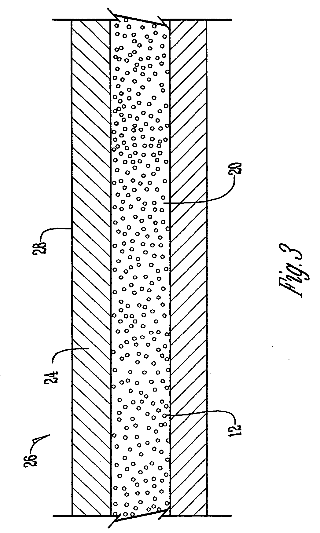 Method of recycling a nuclear-cored battery