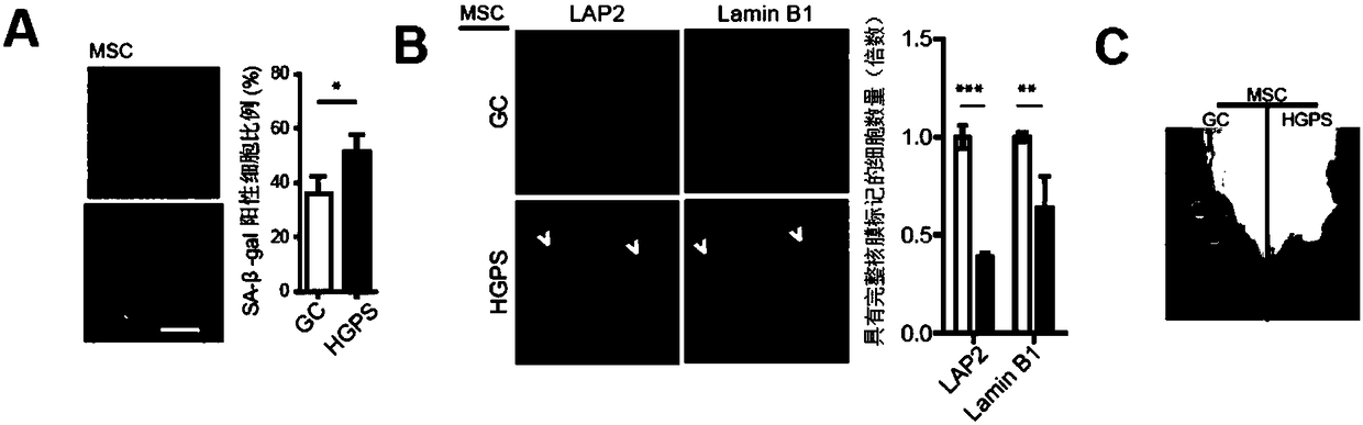 Use of oltipraz in reversing the aging phenotype of human childhood progeria