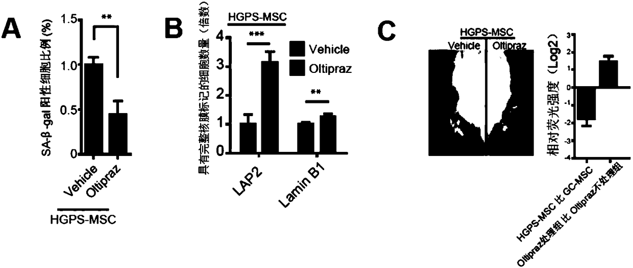 Use of oltipraz in reversing the aging phenotype of human childhood progeria