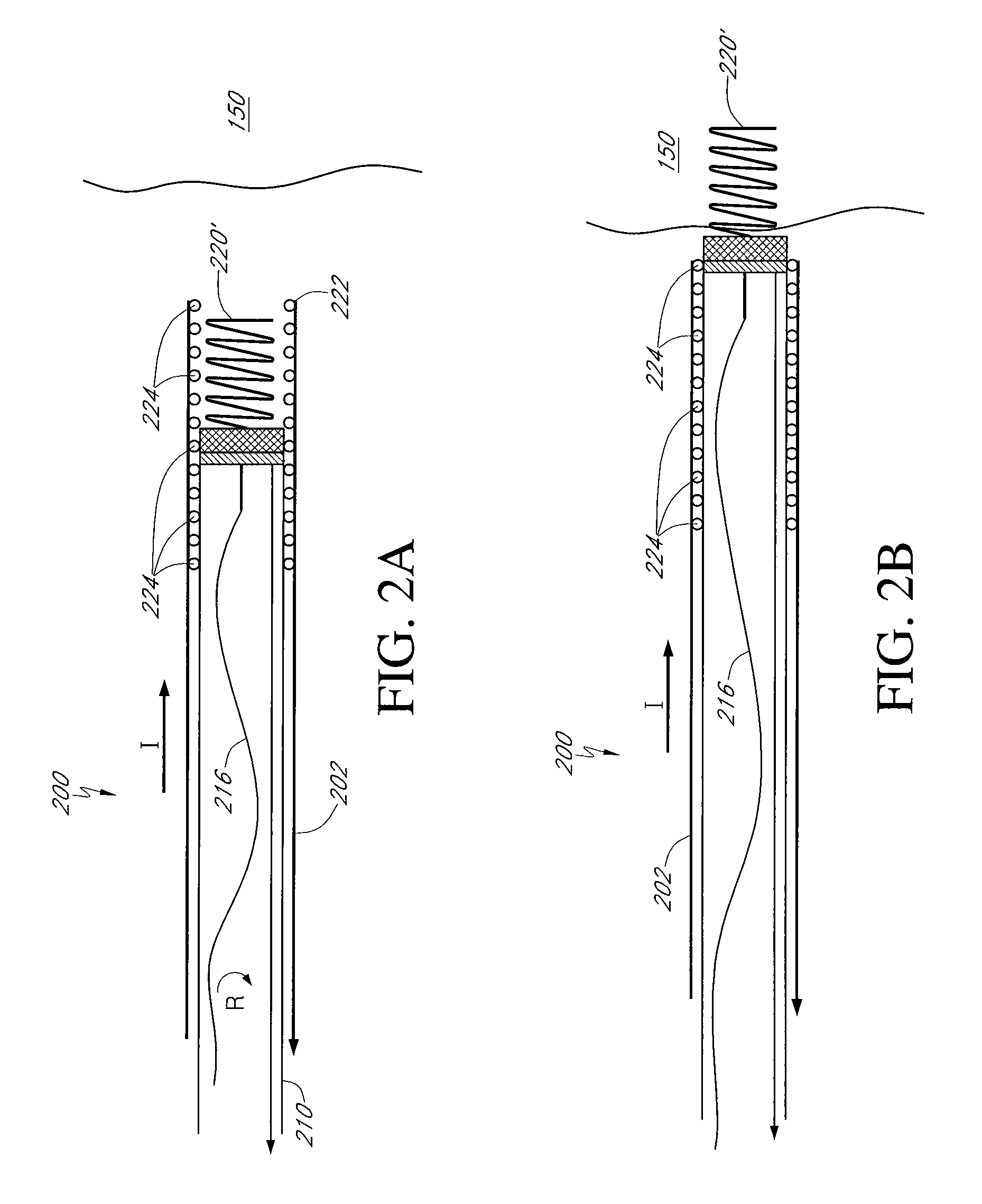 Implantable lead/electrode delivery measurement and feedback system