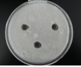 A strain of Lactobacillus plantarum