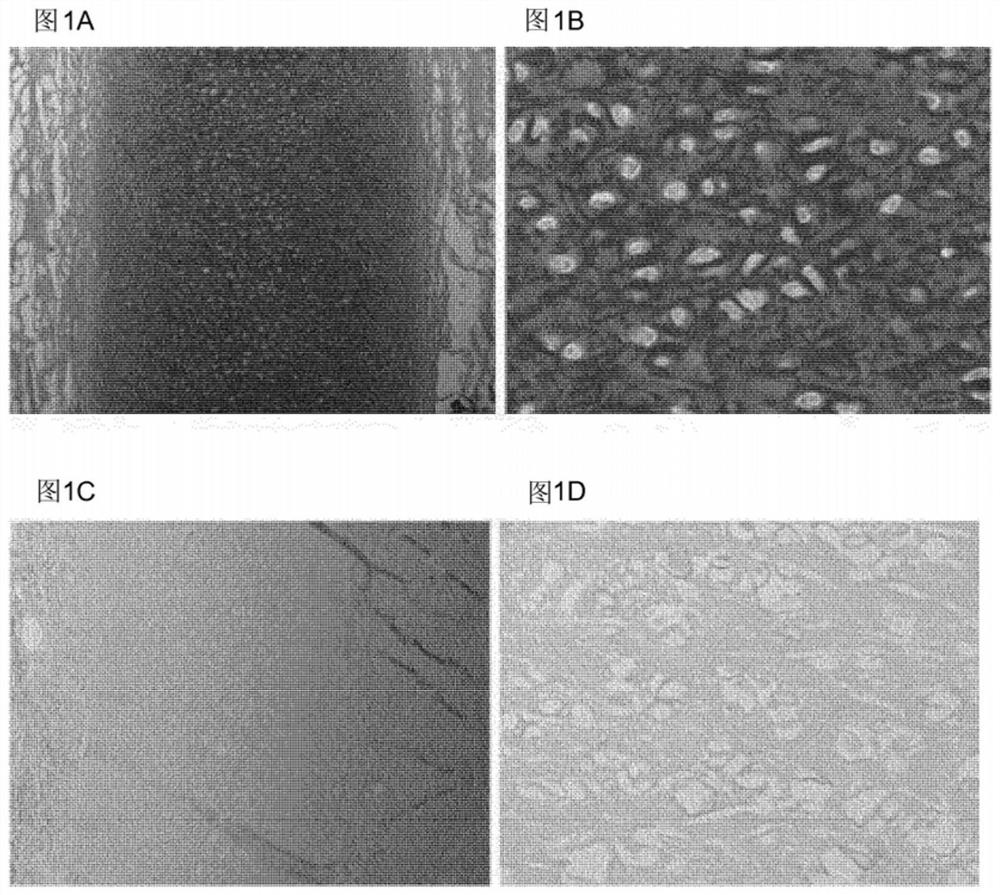 Elastin reduction allowing recellularization of cartilage implants