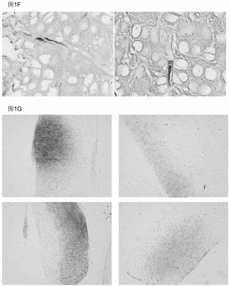 Elastin reduction allowing recellularization of cartilage implants