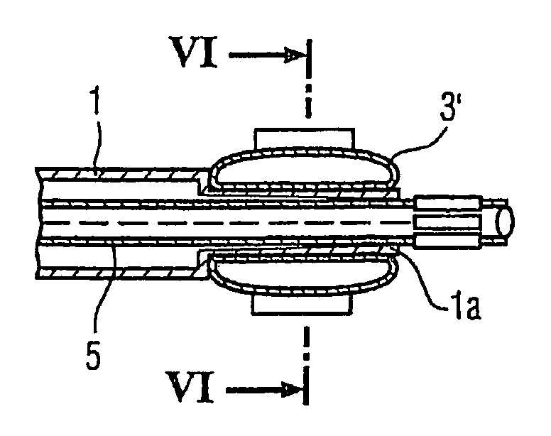 Catheter device for applying a medical cutting balloon intervention