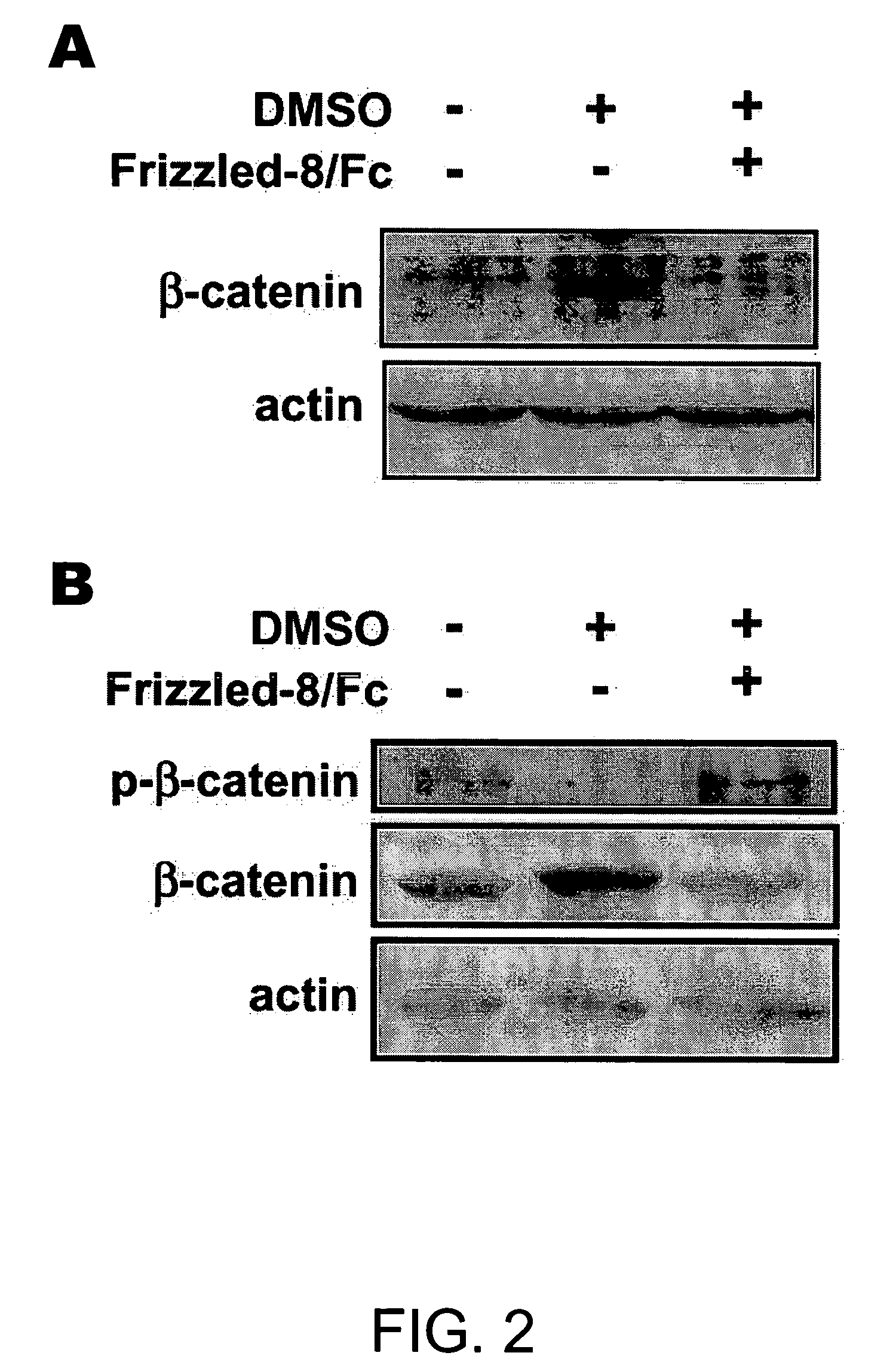 Wnt as a factor for cardiac myogenesis