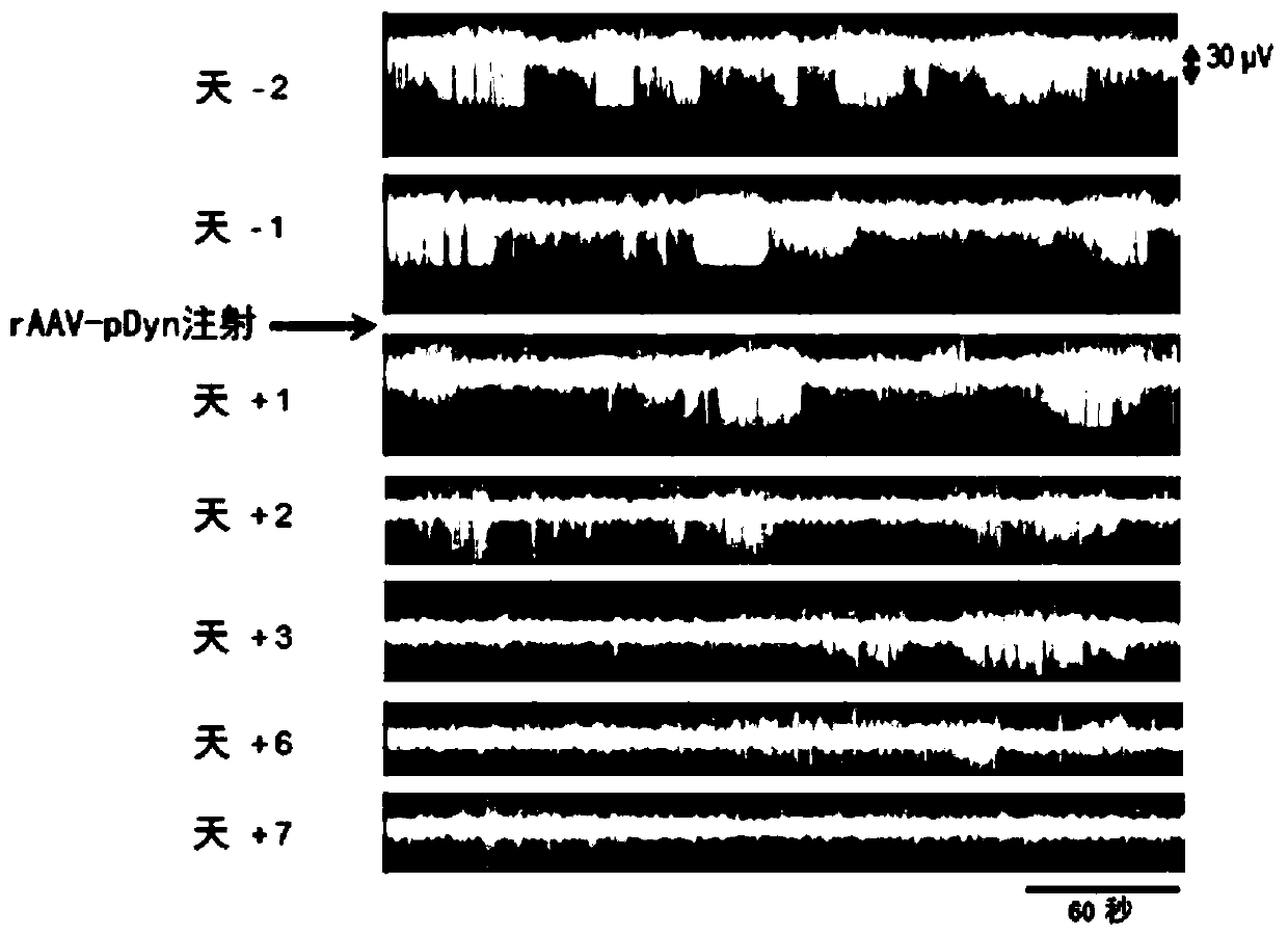 Neuropeptide-expressing vectors and methods for treatment of epilepsy