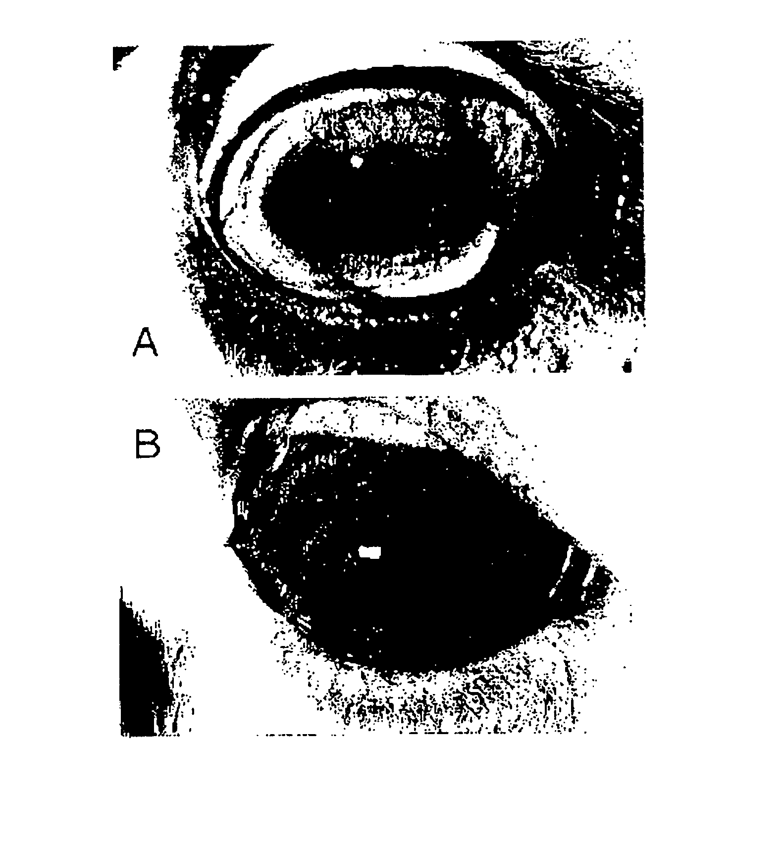 Ocular Tissue Modification