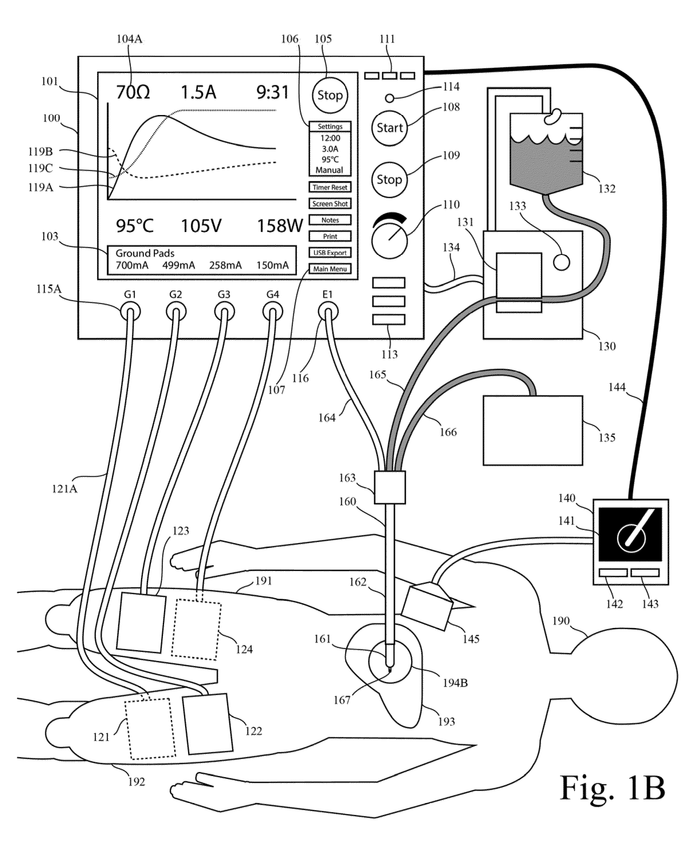 Electrosurgical generator