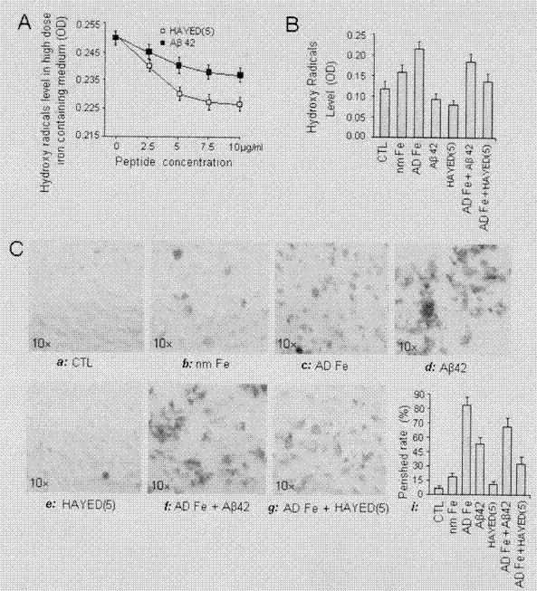 Polypeptide for removing iron and free radicals in brain and preparation method and application thereof