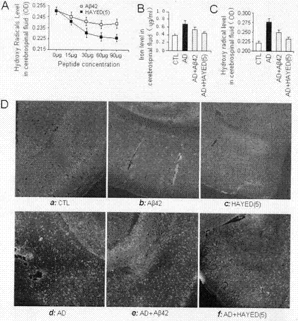 Polypeptide for removing iron and free radicals in brain and preparation method and application thereof