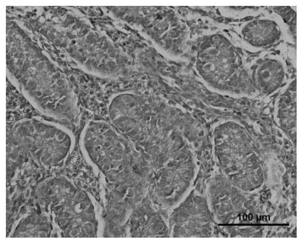 A kind of cryopreservation liquid and preparation method thereof