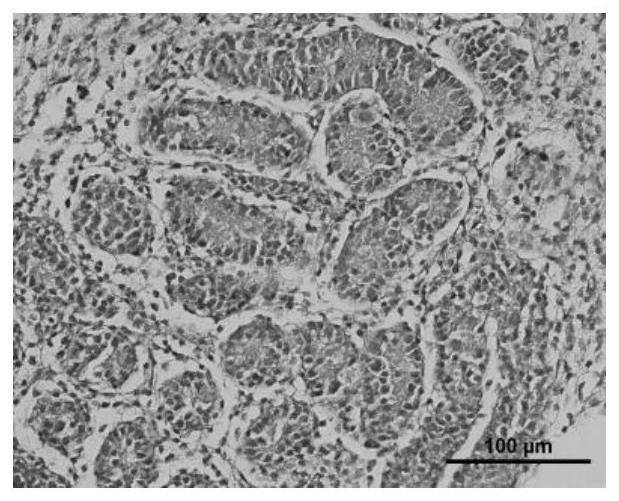 A kind of cryopreservation liquid and preparation method thereof