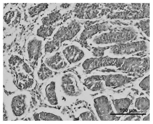 A kind of cryopreservation liquid and preparation method thereof