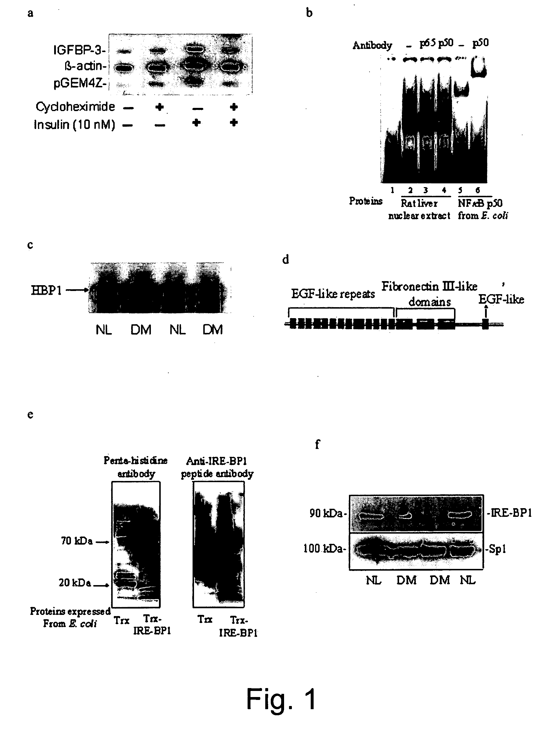 Transcript factor and an Akt substrate related to transcriptional action of insulin and applications of same