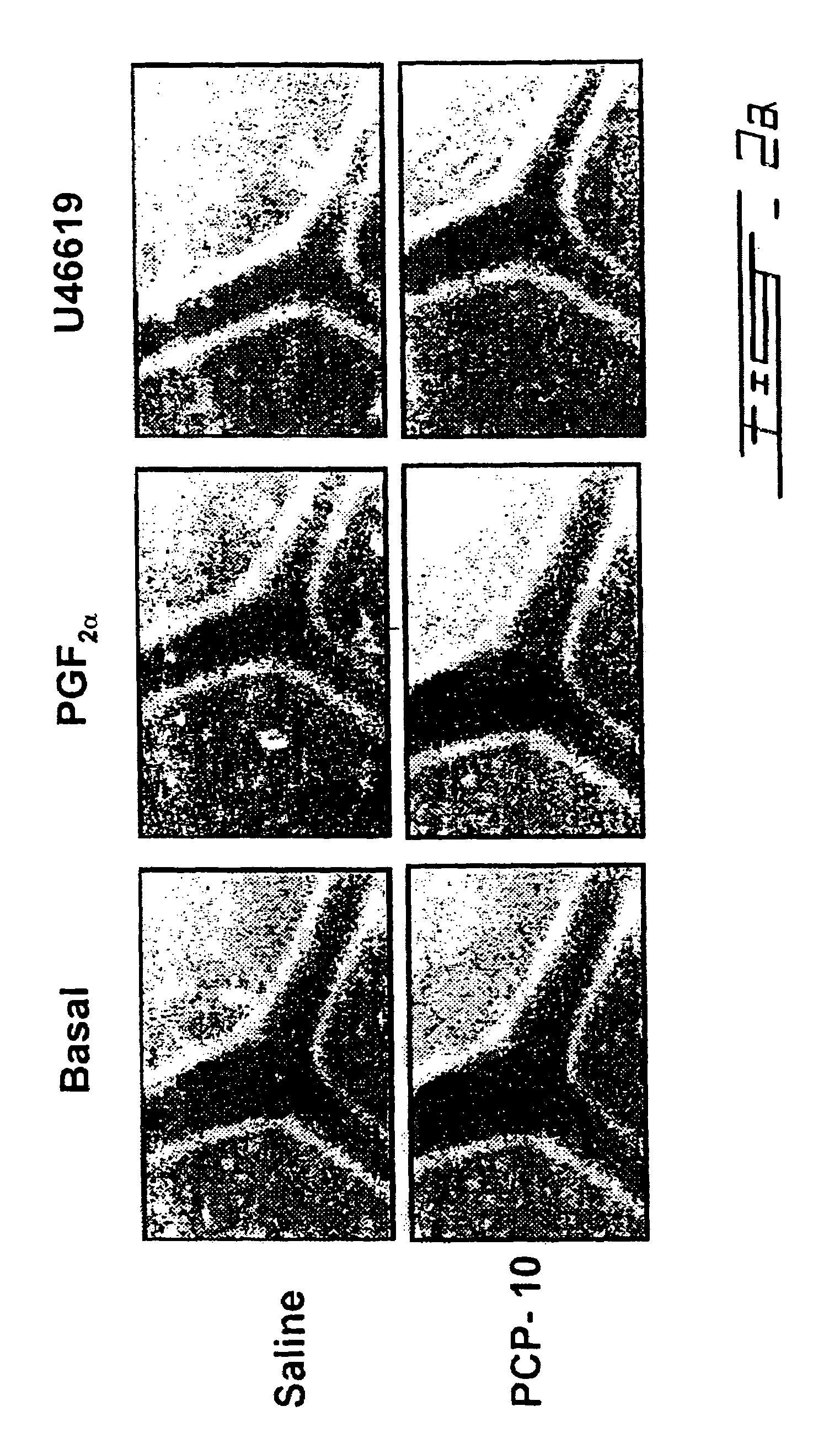 Peptide antagonists of prostaglandin F2α receptor