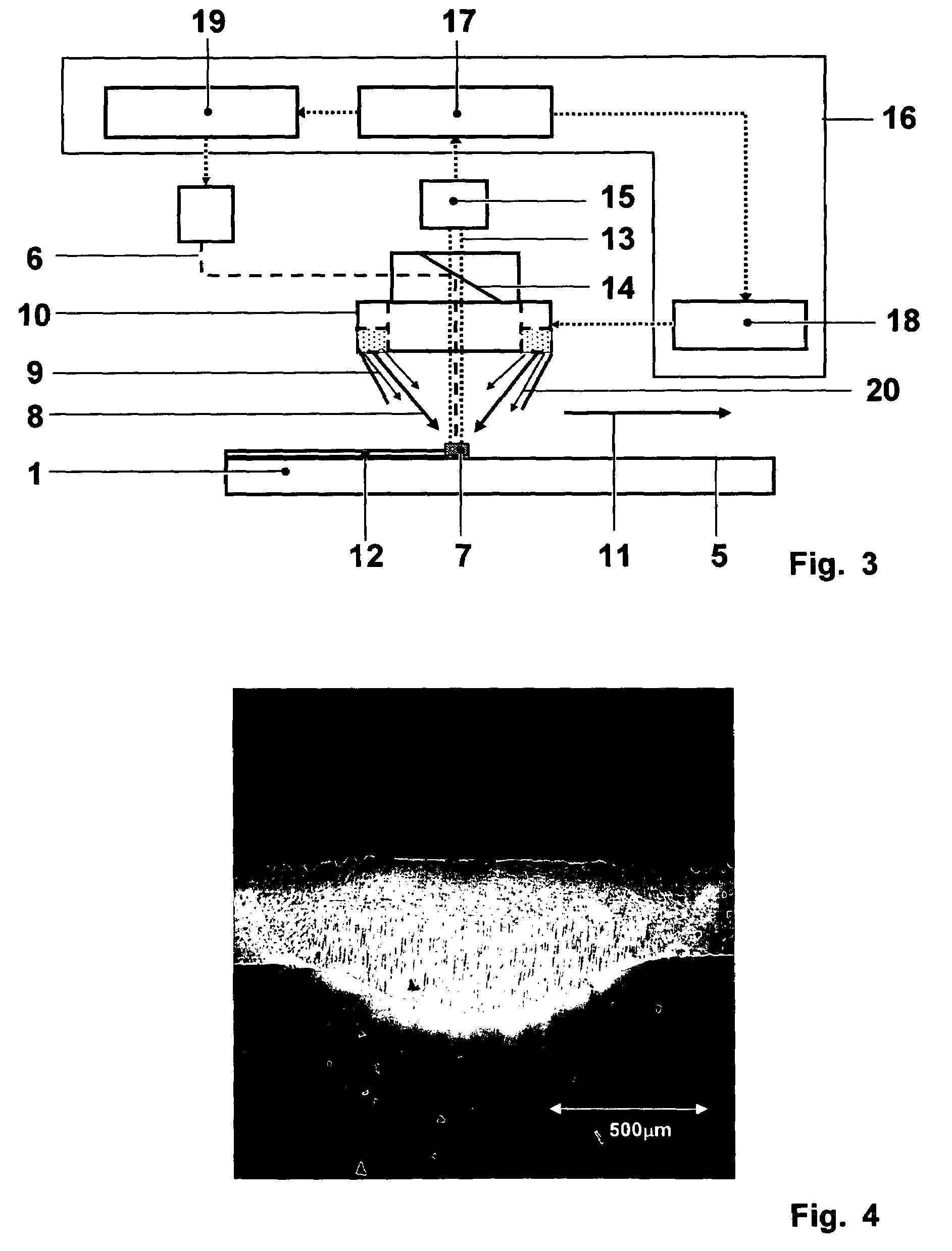 Method of controlled remelting of or laser metal forming on the surface of an article