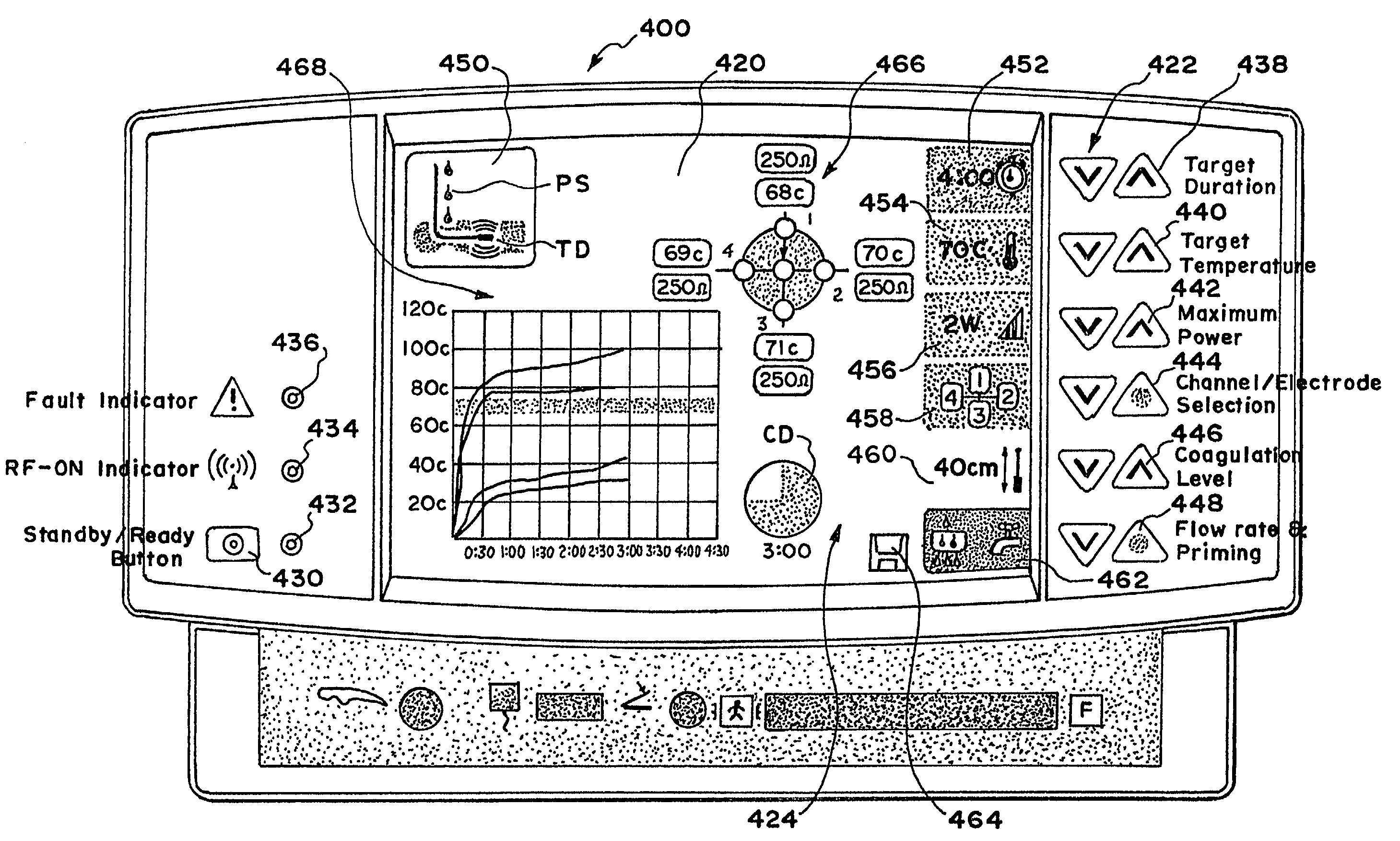 Graphical user interface for association with an electrode structure deployed in contact with a tissue region