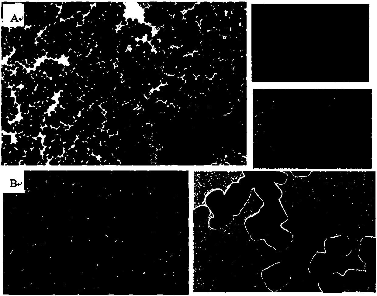 Upconversion-immunochromatography test strip used for detecting Escherichia coli O157:H7, and detection method thereof