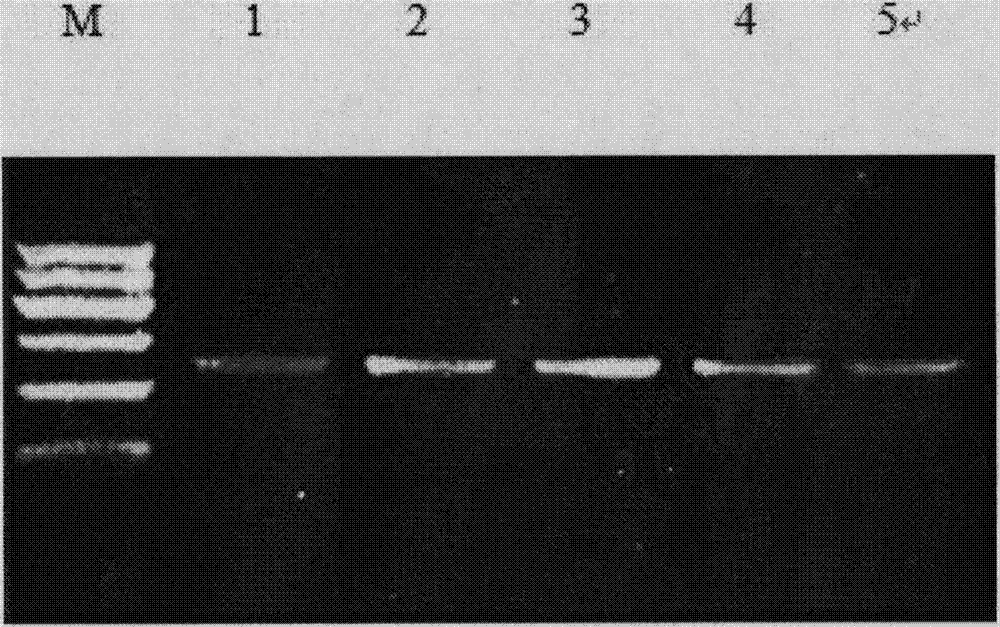 Application of NOTCH3 and JAG2 gene SNP ((Single Nucleotide Polymorphism)) loci