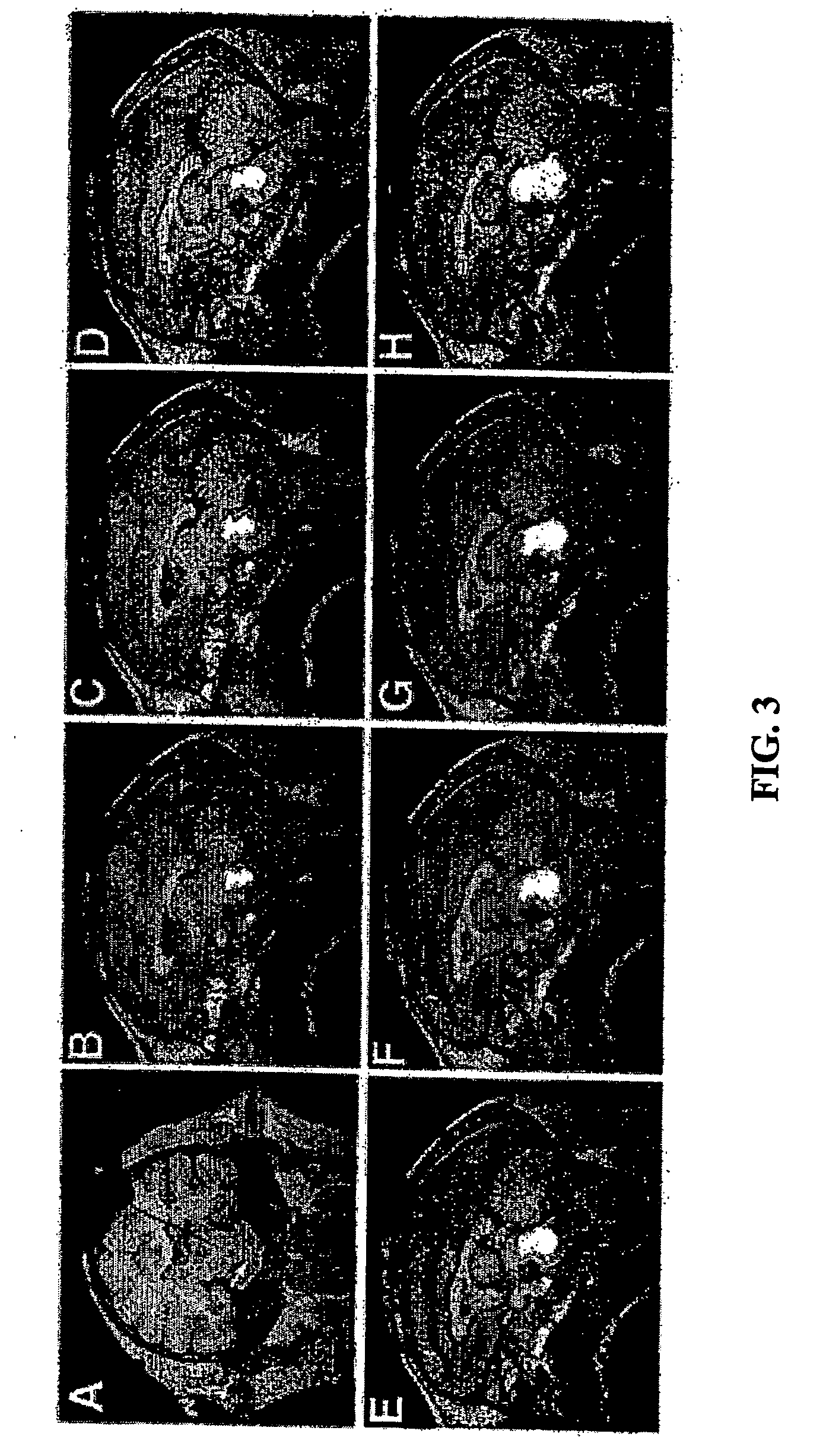 Method for convection enhanced delivery of therapeutic agents