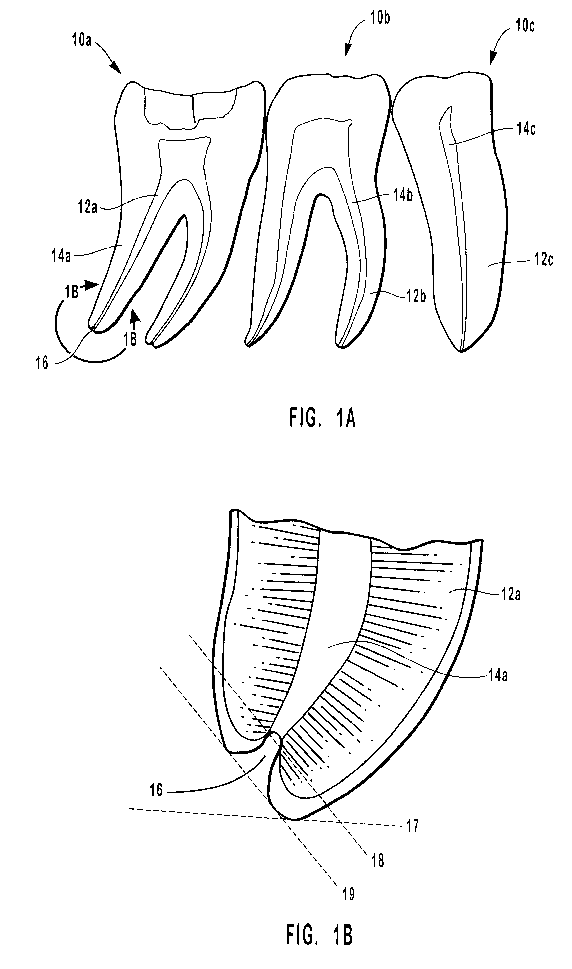 Endodontic systems and methods for the anatomical, sectional and progressive corono-apical preparation of root canals with instruments utilizing stops