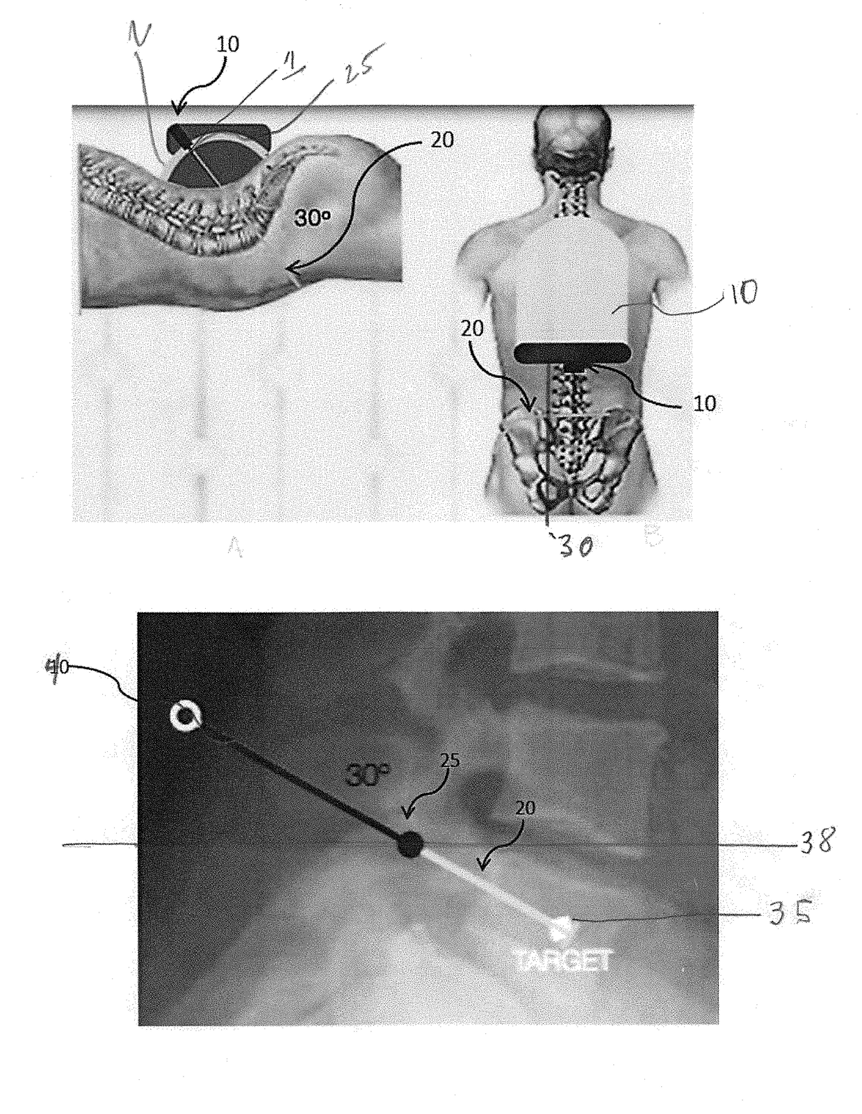 Surgical Targeting Systems and Methods