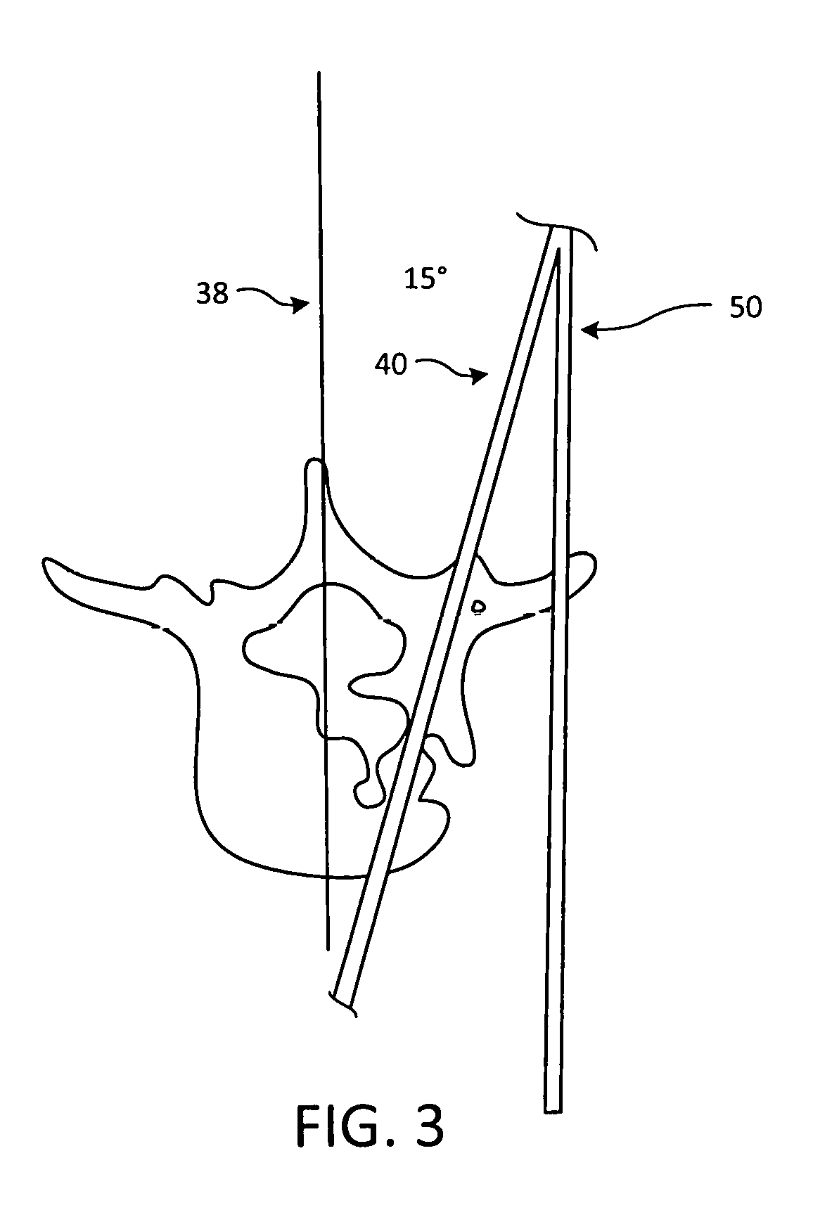 Surgical Targeting Systems and Methods