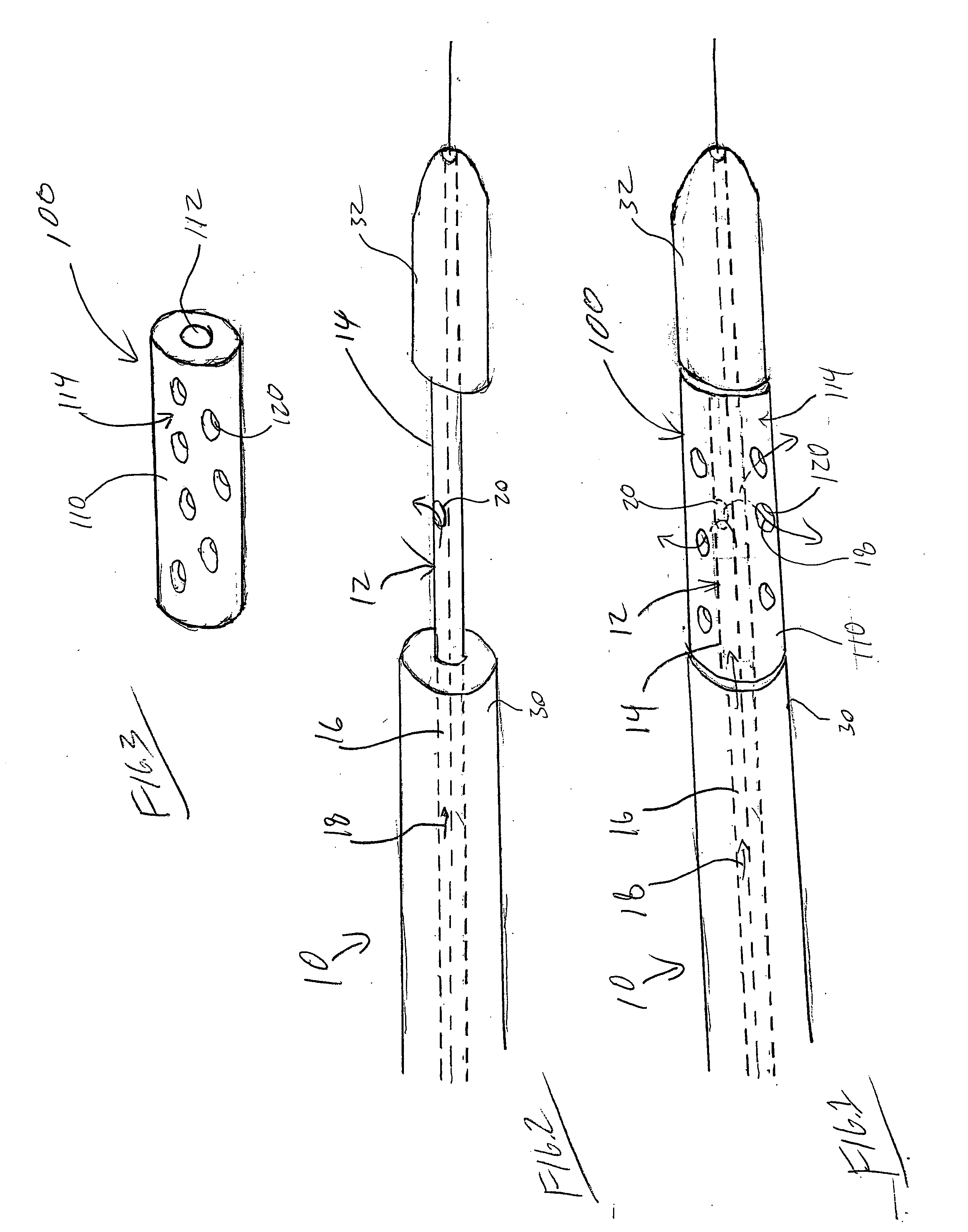 Rotating stent delivery system for side branch access and protection and method of using same