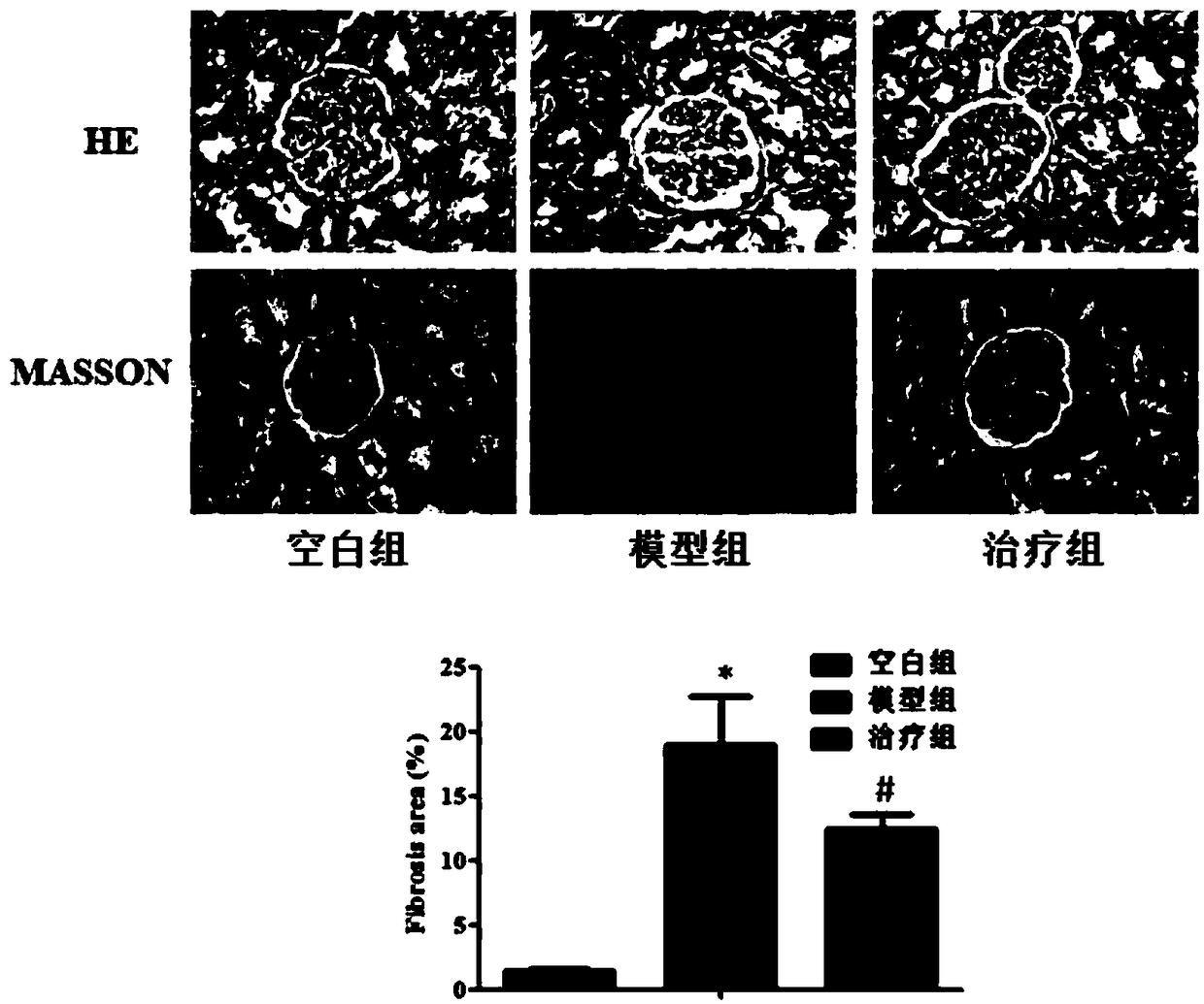 New application of medicine composition