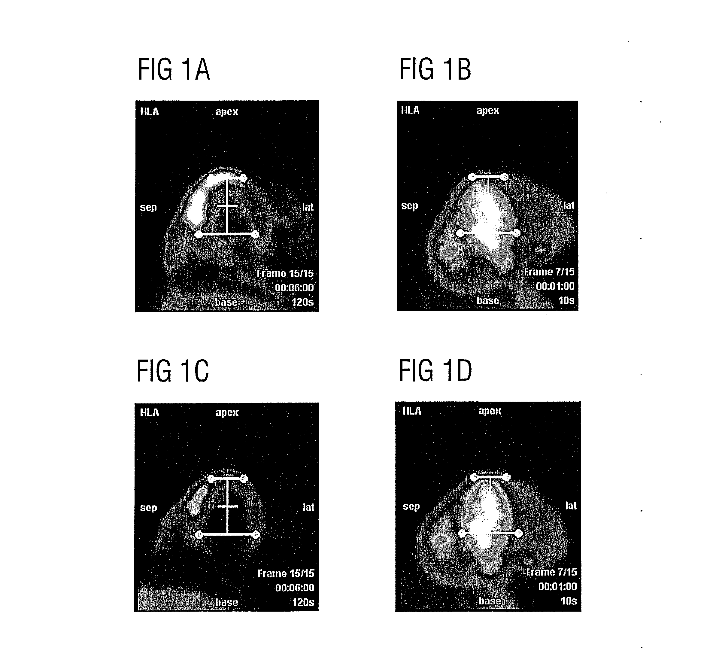 Reorientation of cardiac images